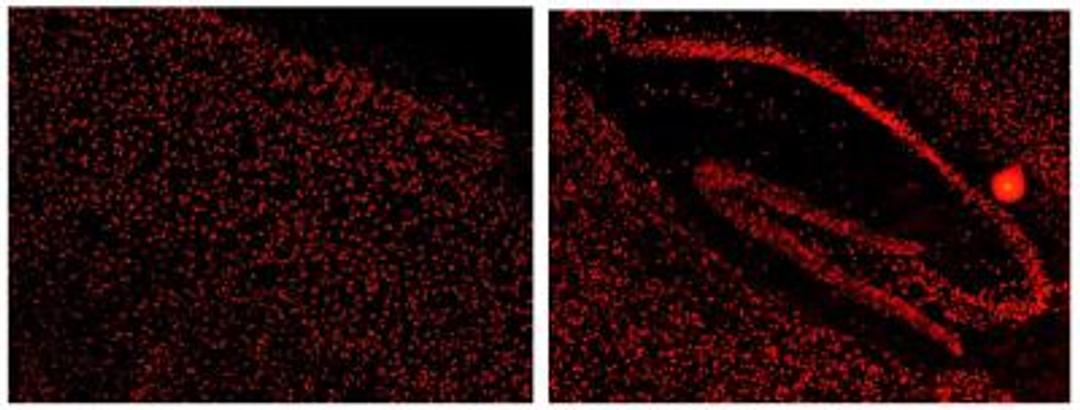 Immunohistochemistry-Frozen: KHSRP Antibody [NBP1-18910] - KSRP immunostaining in mouse cerebral cortex and hippocampus. Cell were stained with Novus KSRP. This KSRP antibody was also used for immunoprecipation and western blot analyses. Image from confirmed customer review.