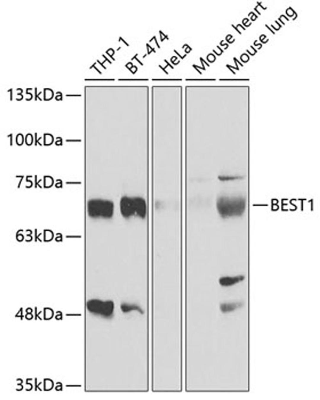 Western blot - BEST1 antibody (A5735)