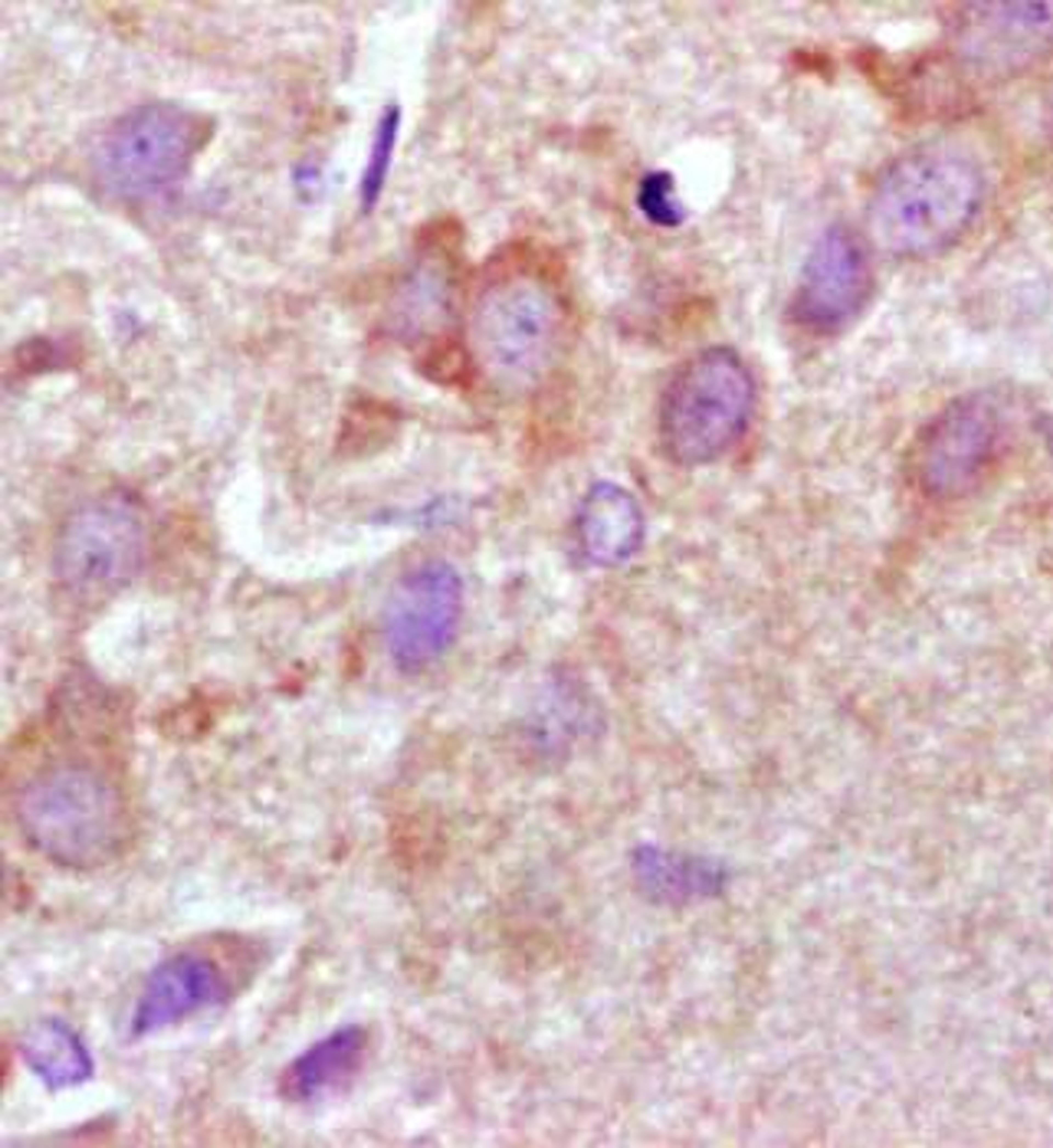 Immunohistochemical analysis of formalin fixed and paraffin embedded rat brain tissue using SYT1 antibody