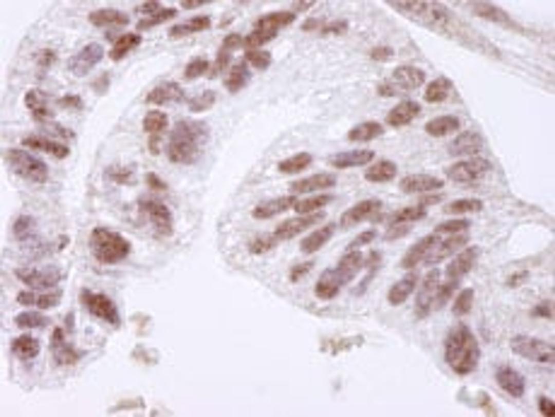 Detection of human CTCF by immunohistochemistry.