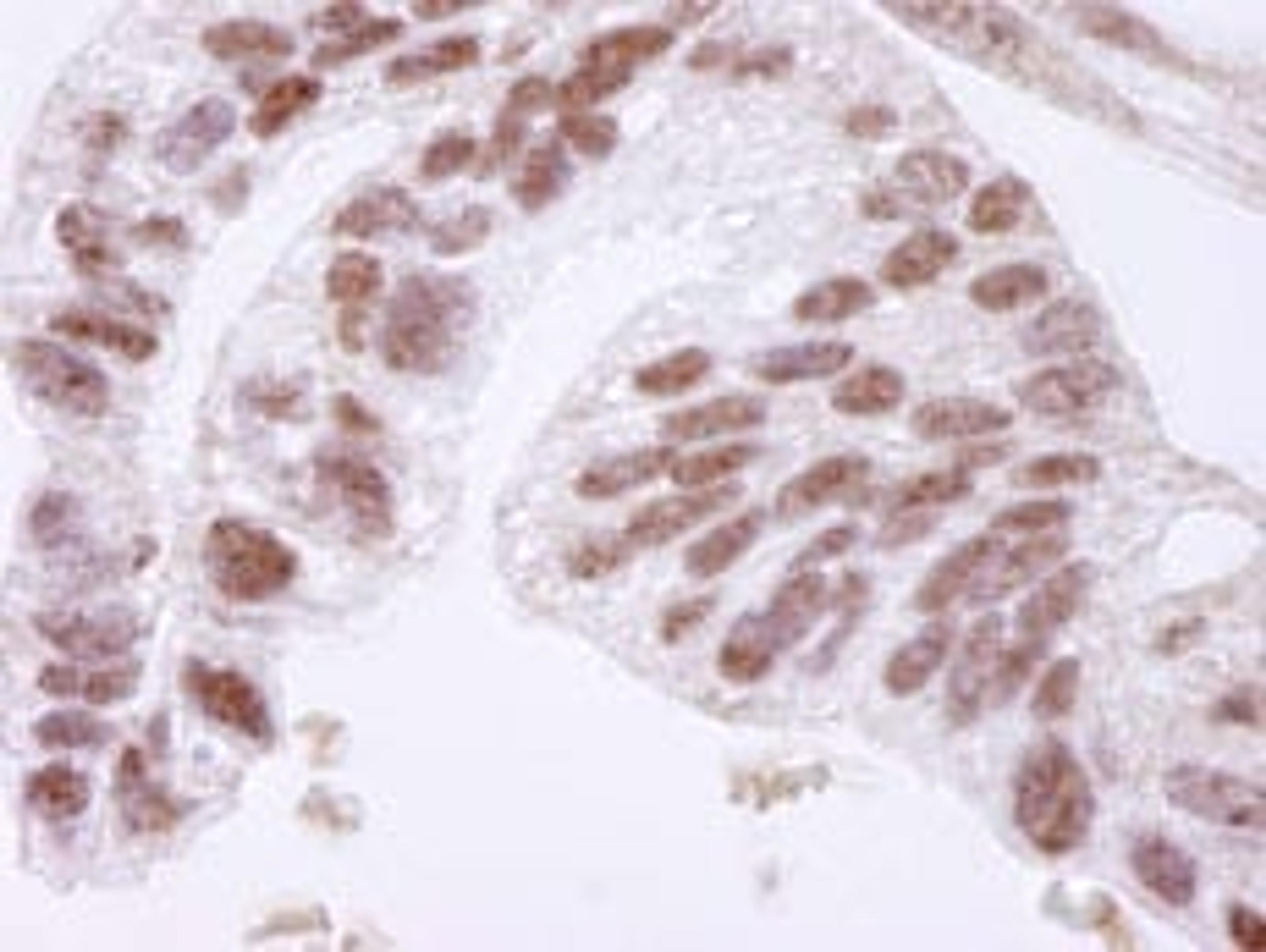 Detection of human CTCF by immunohistochemistry.