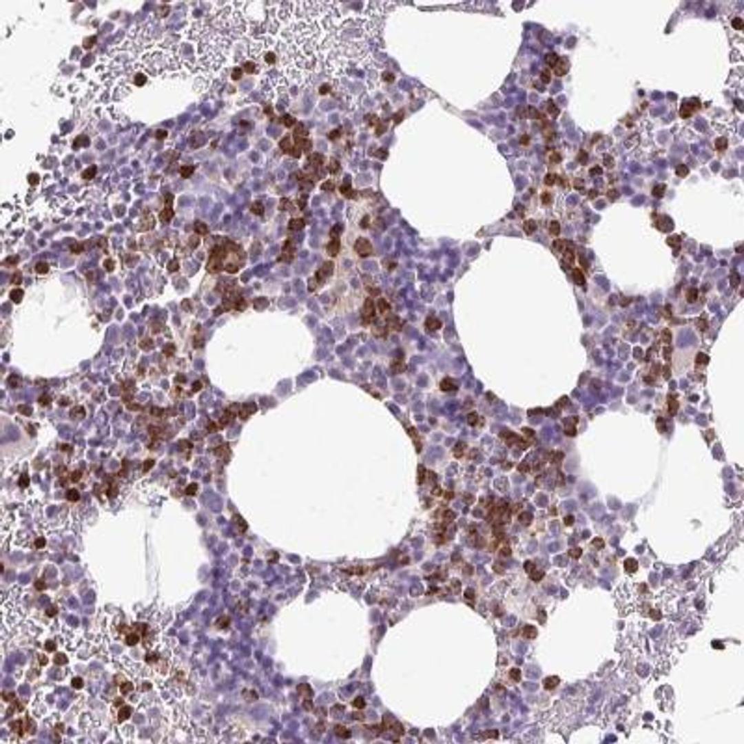 Immunohistochemistry: 5-HT3E Antibody [NBP2-33578] - Immunohistochemical staining of human bone marrow shows strong cytoplasmic positivity in hematopoietic cells.