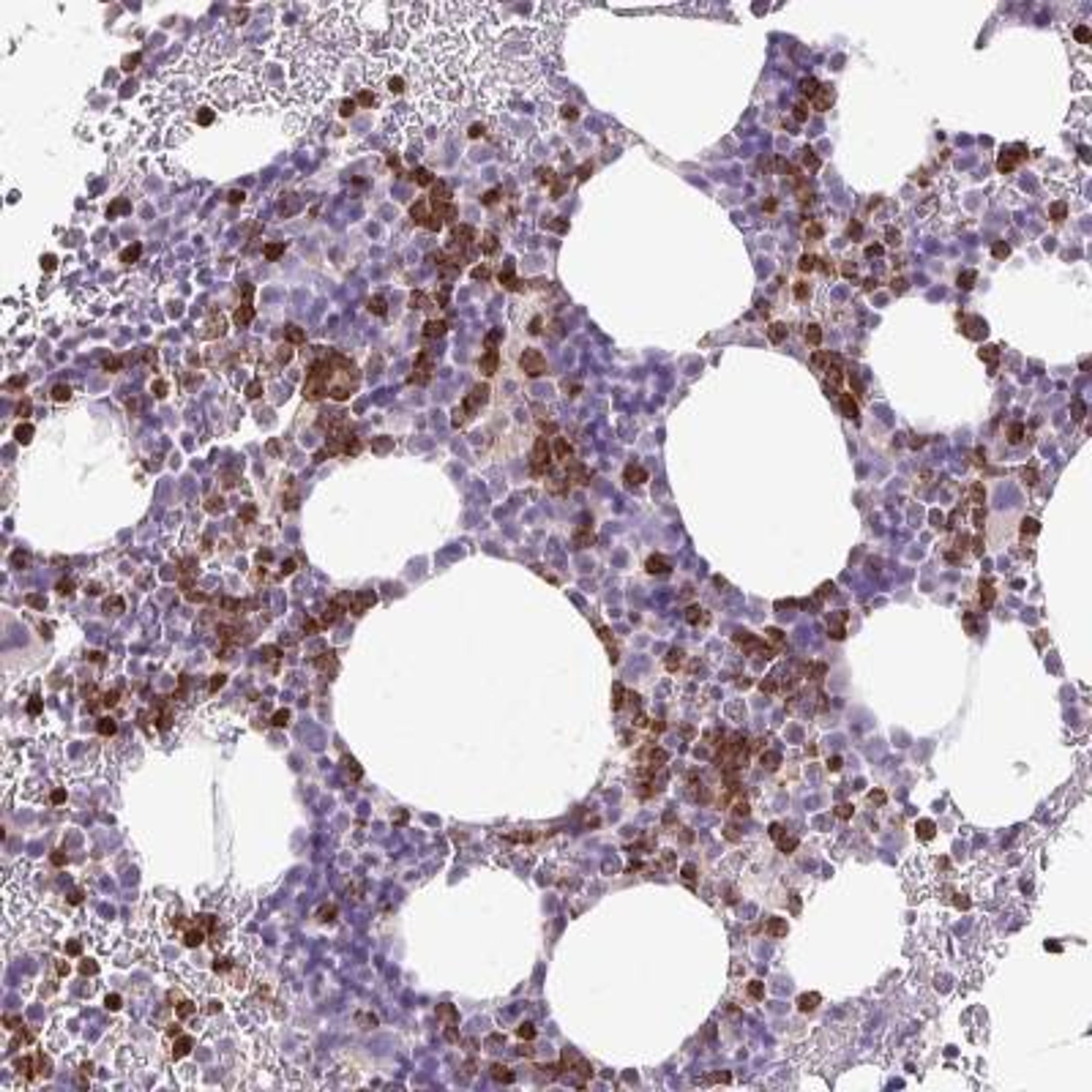 Immunohistochemistry: 5-HT3E Antibody [NBP2-33578] - Immunohistochemical staining of human bone marrow shows strong cytoplasmic positivity in hematopoietic cells.