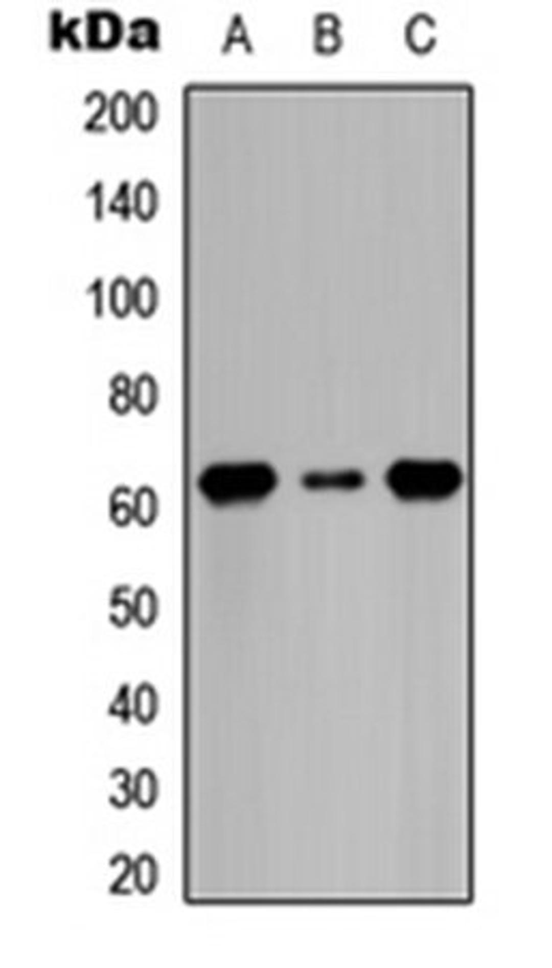 Western blot analysis of HeLa serum starvation-treated (Lane 1), Raw264.7 serum starvation-treated (Lane 2), H9C2 serum starvation-treated (Lane 3) whole cell lysates using CDC6 (phospho-S54) antibody