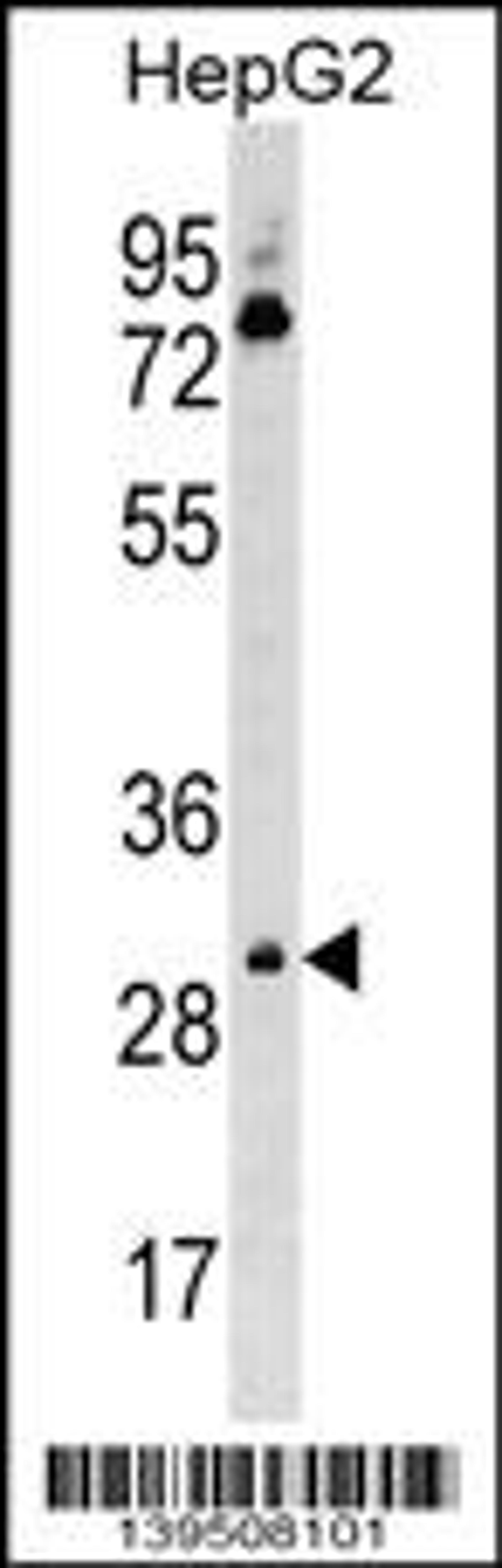 Western blot analysis in HepG2 cell line lysates (35ug/lane).