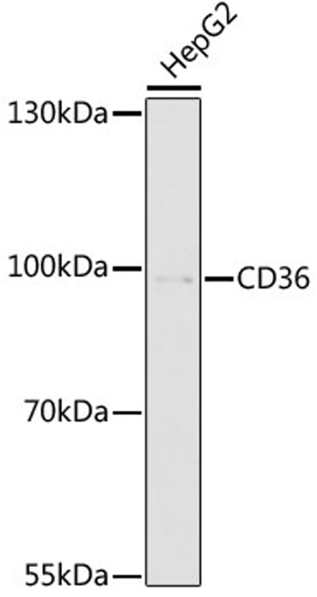 Western blot - CD36 antibody (A17339)