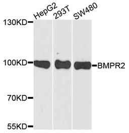 Western blot - BMPR2 antibody (A5666)