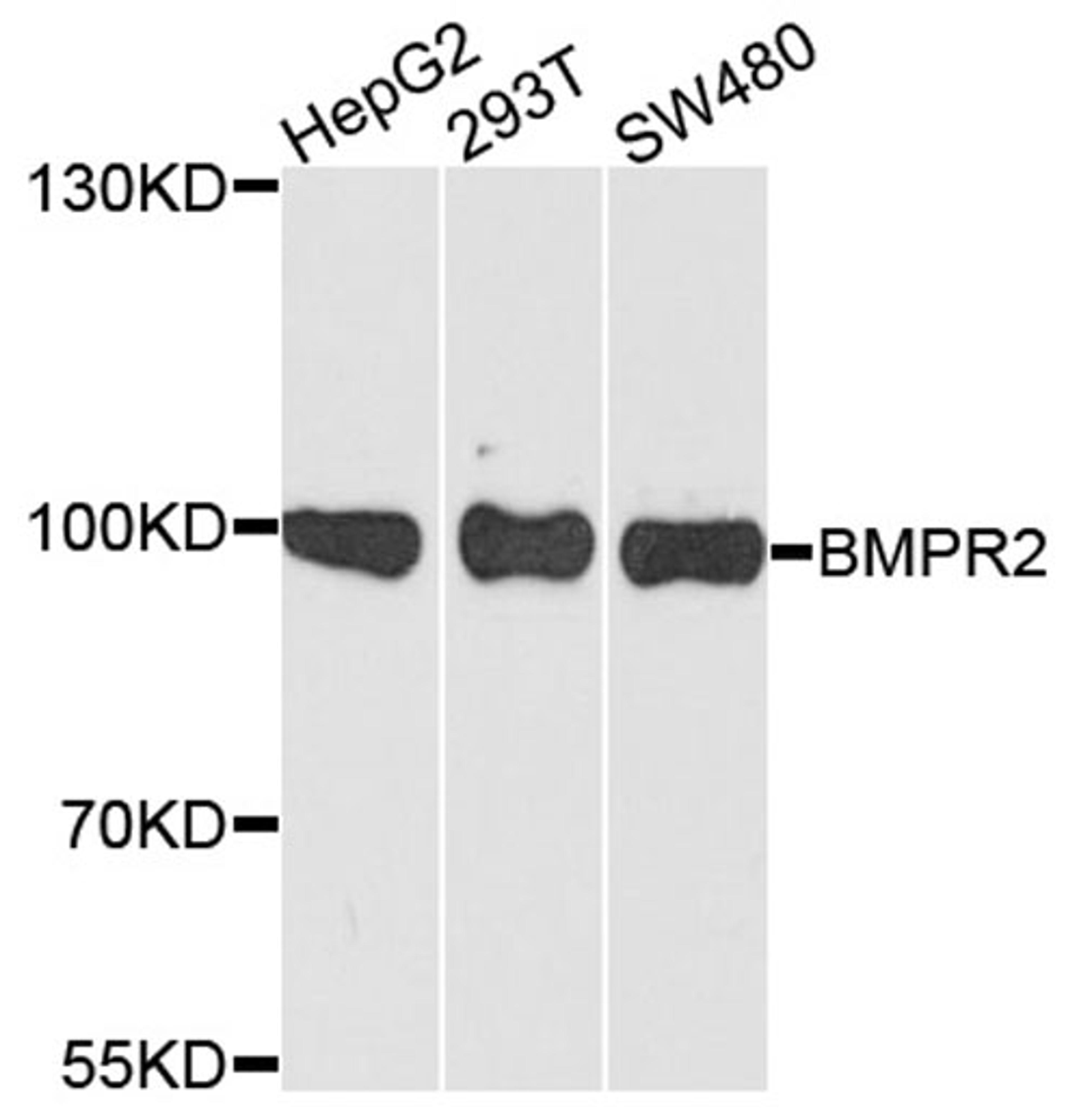 Western blot - BMPR2 antibody (A5666)