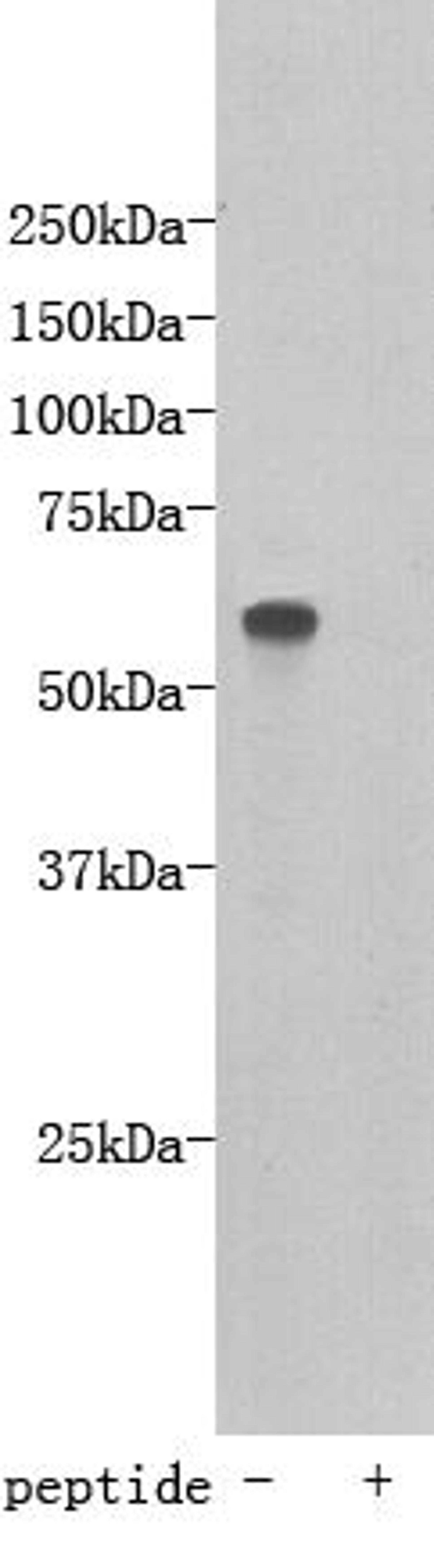 Western Blot analysis of D3 using Transmembrane protein 132E antibody