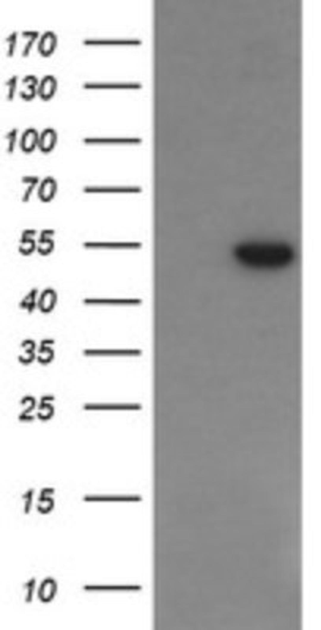 Western Blot: PGD Antibody (2A5) [NBP2-45880] - Analysis of HEK293T cells were transfected with the pCMV6-ENTRY control (Left lane) or pCMV6-ENTRY PGD.