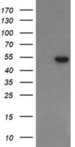 Western Blot: PGD Antibody (2A5) [NBP2-45880] - Analysis of HEK293T cells were transfected with the pCMV6-ENTRY control (Left lane) or pCMV6-ENTRY PGD.