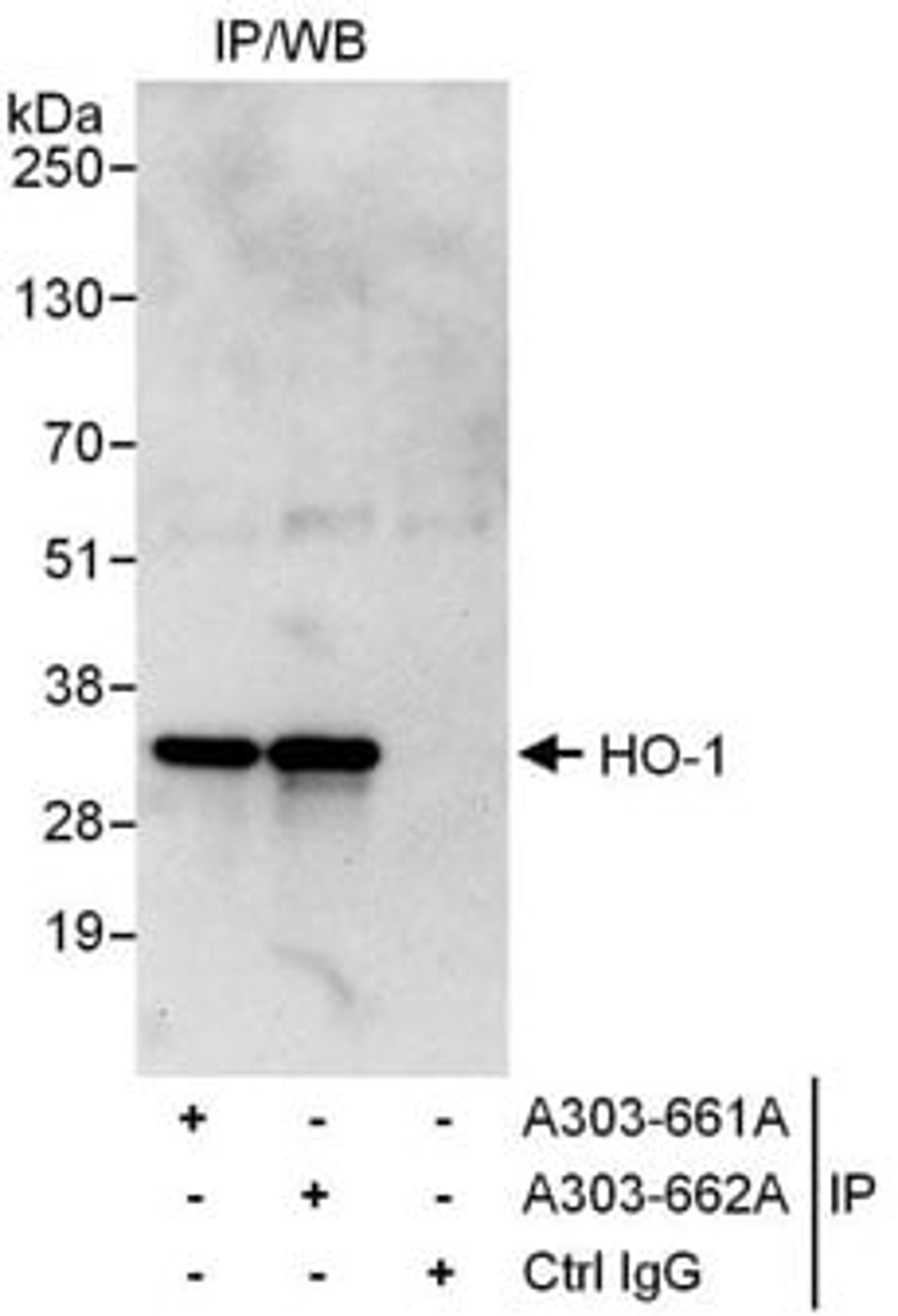 Detection of human HO-1 by western blot of immunoprecipitates.