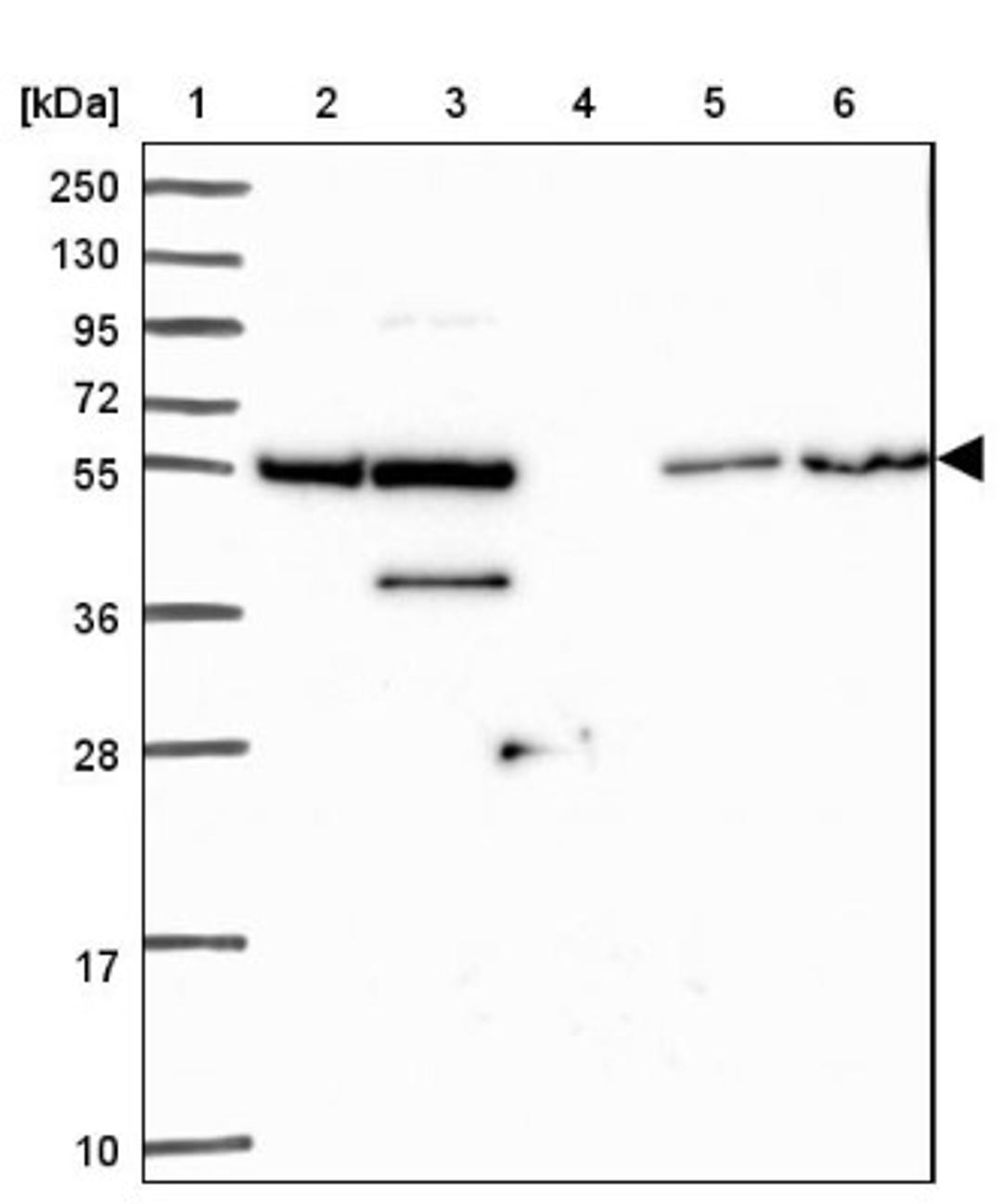 Western Blot: ZNF300 Antibody [NBP2-13566] - Lane 1: Marker [kDa] 250, 130, 95, 72, 55, 36, 28, 17, 10<br/>Lane 2: Human cell line RT-4<br/>Lane 3: Human cell line U-251MG sp<br/>Lane 4: Human plasma (IgG/HSA depleted)<br/>Lane 5: Human liver tissue<br/>Lane 6: Human tonsil tissue