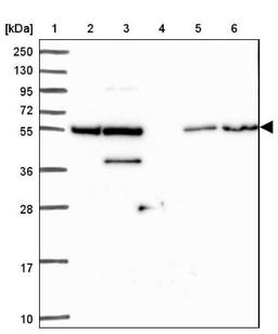 Western Blot: ZNF300 Antibody [NBP2-13566] - Lane 1: Marker [kDa] 250, 130, 95, 72, 55, 36, 28, 17, 10<br/>Lane 2: Human cell line RT-4<br/>Lane 3: Human cell line U-251MG sp<br/>Lane 4: Human plasma (IgG/HSA depleted)<br/>Lane 5: Human liver tissue<br/>Lane 6: Human tonsil tissue