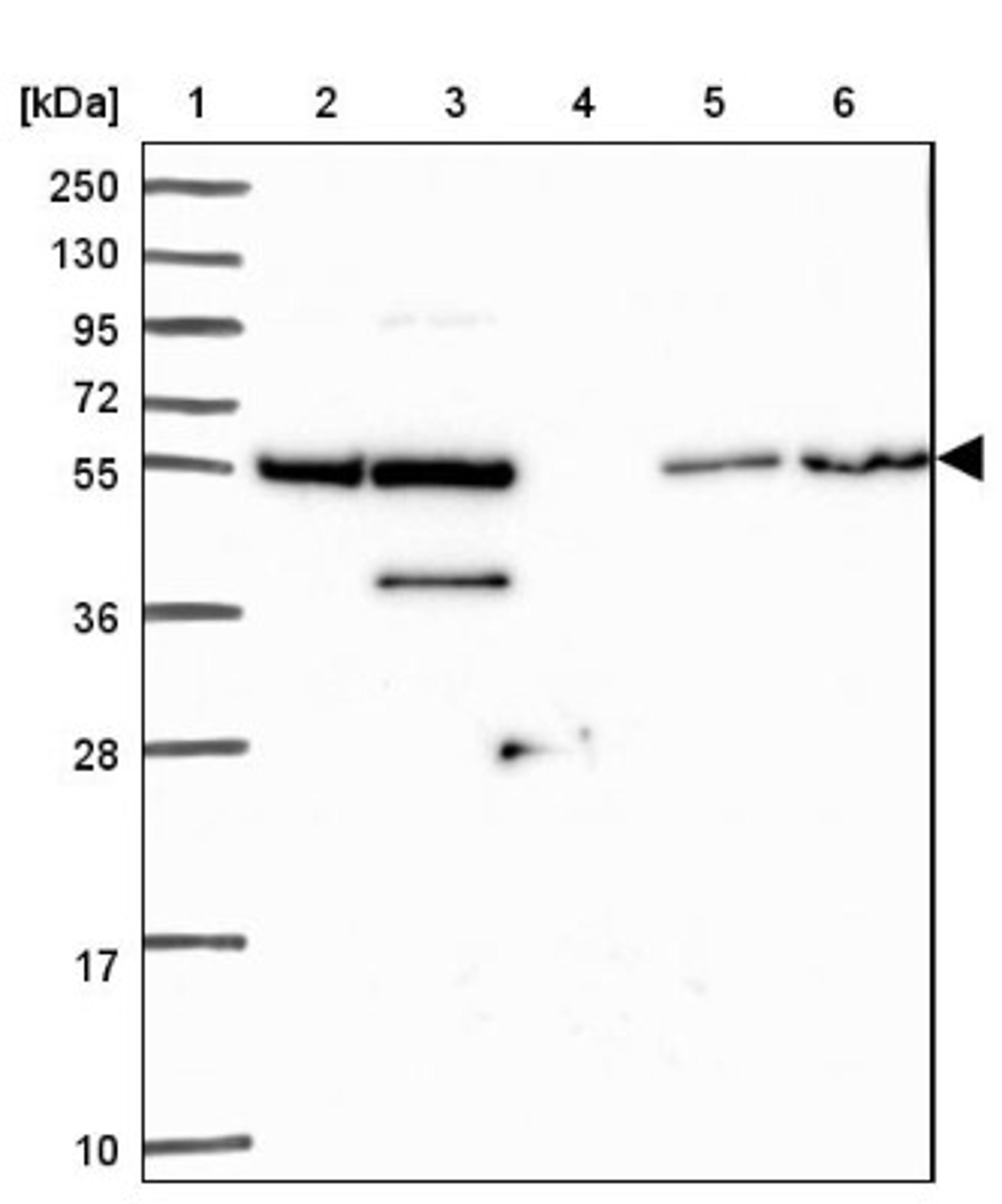 Western Blot: ZNF300 Antibody [NBP2-13566] - Lane 1: Marker [kDa] 250, 130, 95, 72, 55, 36, 28, 17, 10<br/>Lane 2: Human cell line RT-4<br/>Lane 3: Human cell line U-251MG sp<br/>Lane 4: Human plasma (IgG/HSA depleted)<br/>Lane 5: Human liver tissue<br/>Lane 6: Human tonsil tissue