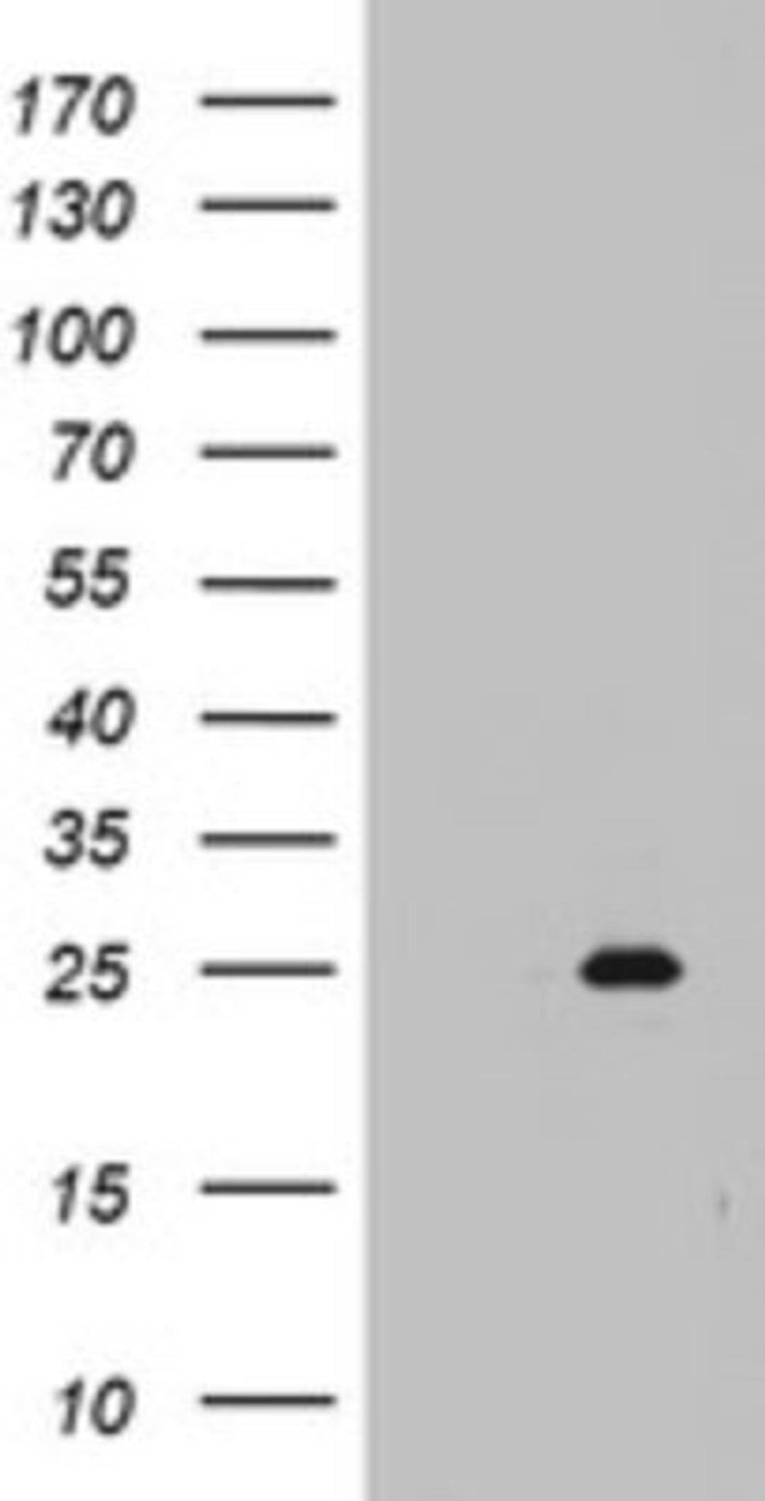 Western Blot: MRPS11 Antibody (2E9) [NBP2-45937] - Analysis of HEK293T cells were transfected with the pCMV6-ENTRY control (Left lane) or pCMV6-ENTRY MRPS11.