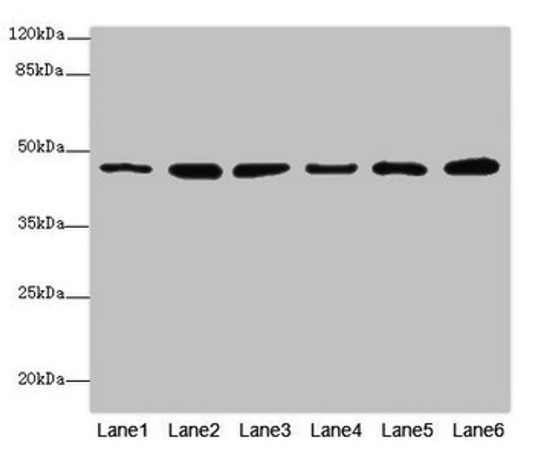 Western blot. All lanes: MPI antibody at 5.12µg/ml. Lane 1: Mouse heart tissue. Lane 2: Mouse kidney tissue. Lane 3: Mouse brain tissue. Lane 4: HepG2 whole cell lysate. Lane 5: 293T whole cell lysate. Lane 6: A549 whole cell lysate. Secondary. Goat polyclonal to rabbit IgG at 1/10000 dilution. Predicted band size: 47, 40 kDa. Observed band size: 47 kDa