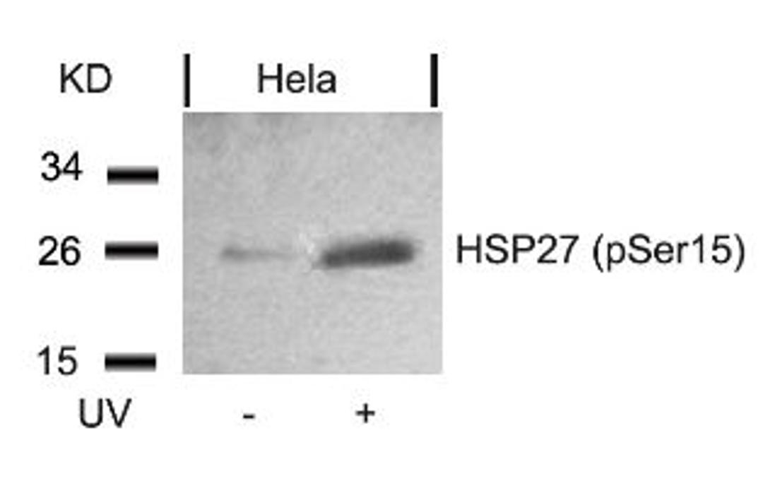 Western blot analysis of lysed extracts from HeLa cells untreated or treated with UV using HSP27 (Phospho-Ser15).