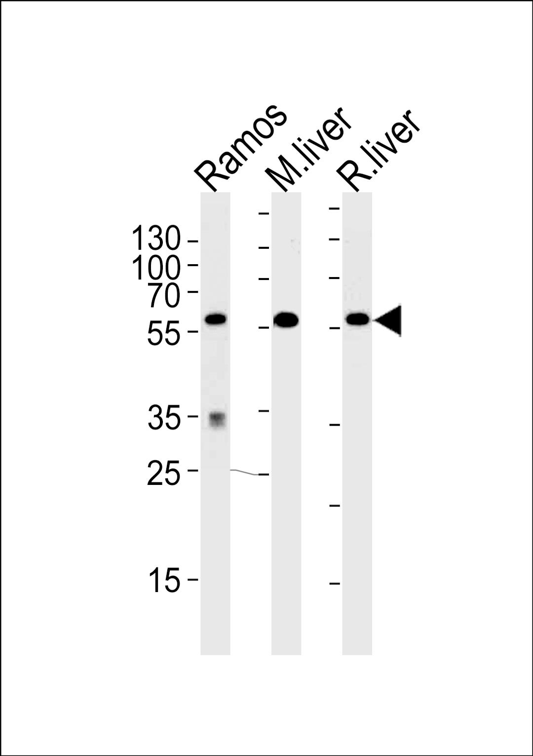 Western blot analysis of lysates from Ramos cell line,mouse liver,rat liver tissue (from left to right),using GPI Antibody .AP9786b was diluted at 1:1000 at each lane.