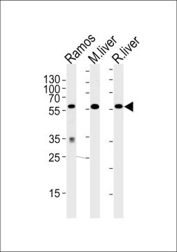 Western blot analysis of lysates from Ramos cell line,mouse liver,rat liver tissue (from left to right),using GPI Antibody .AP9786b was diluted at 1:1000 at each lane.