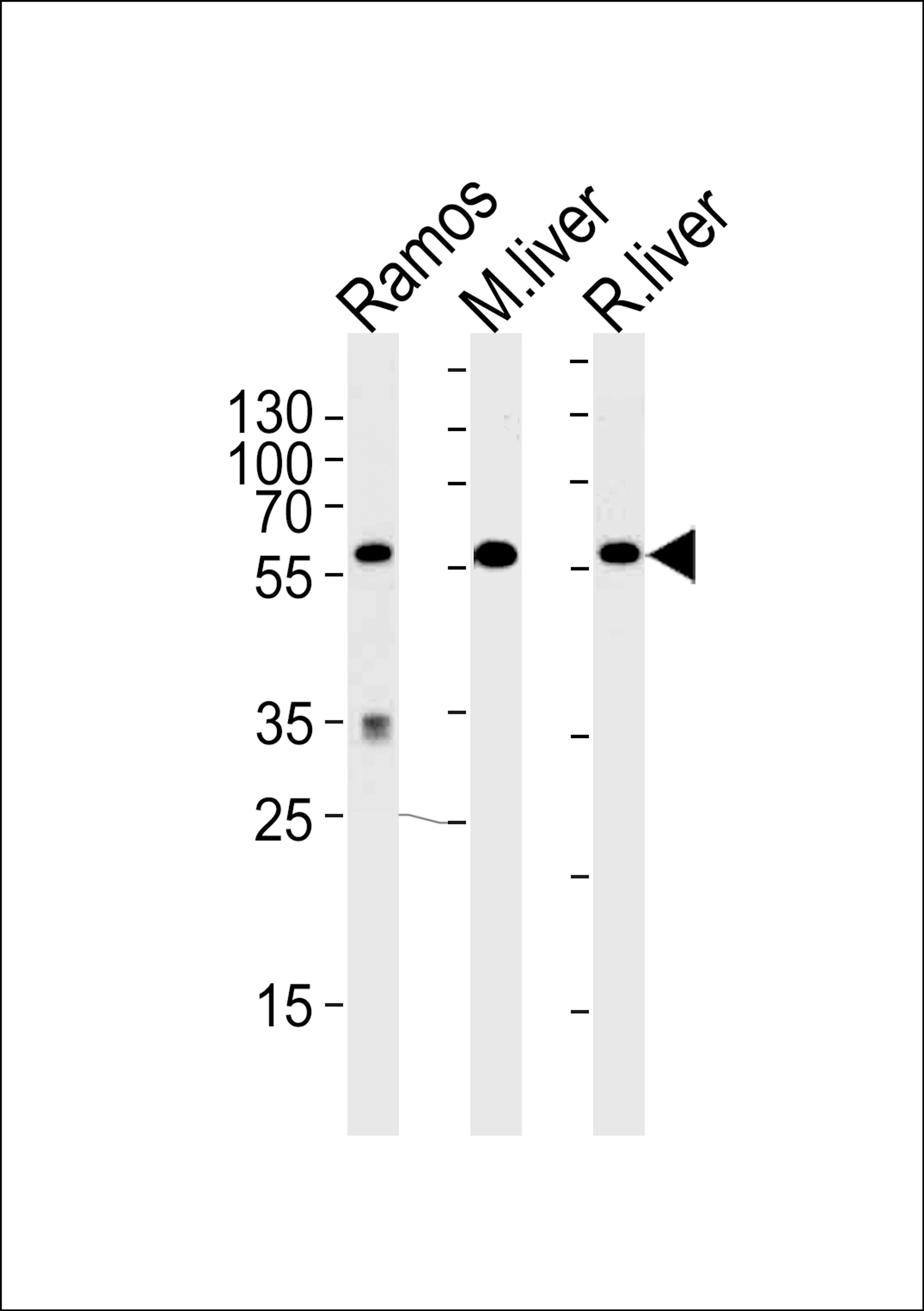 Western blot analysis of lysates from Ramos cell line,mouse liver,rat liver tissue (from left to right),using GPI Antibody .AP9786b was diluted at 1:1000 at each lane.