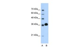 Antibody used in WB on Human Jurkat 0.625 ug/ml.