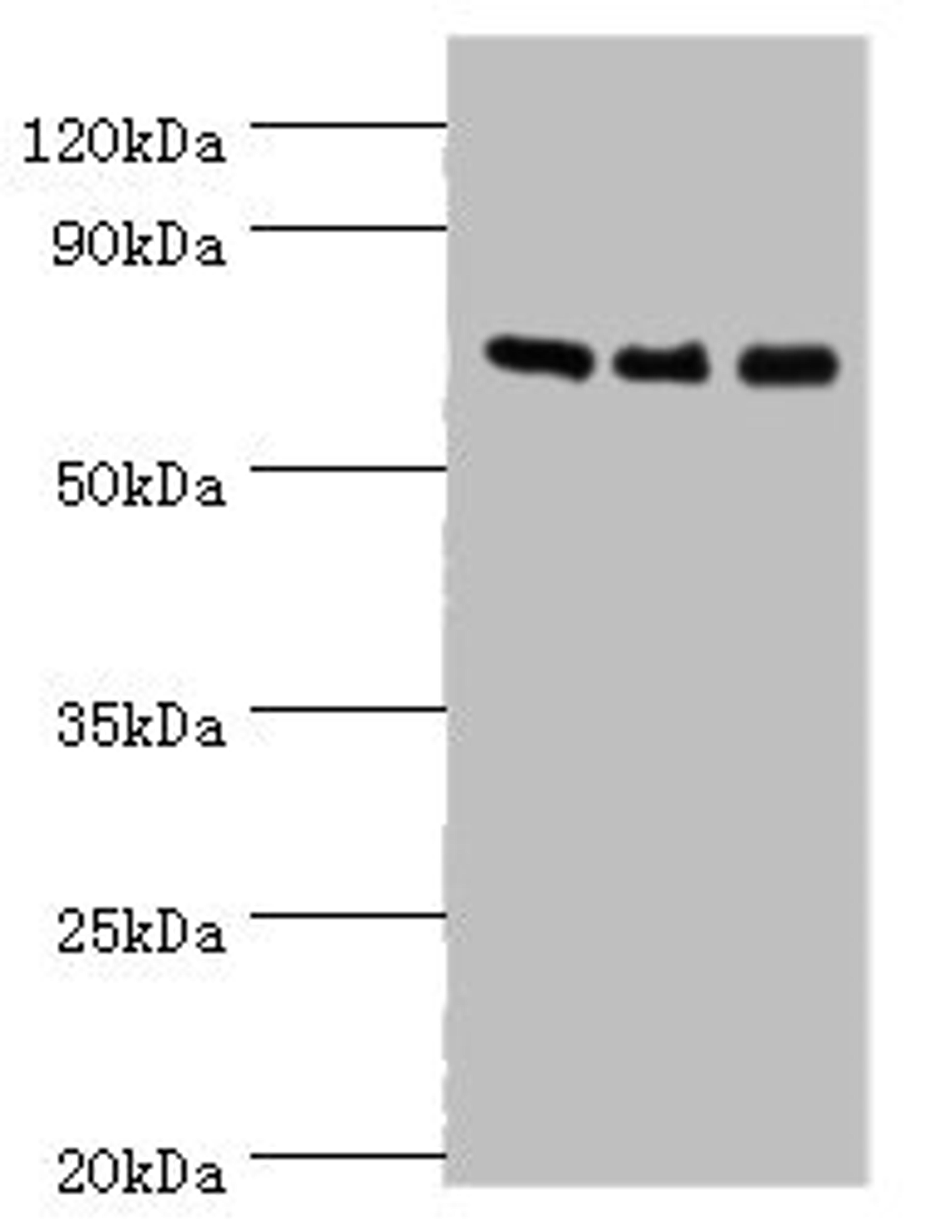Western blot. All lanes: AKAP10 antibody at 7ug/ml. Lane 1: 293T whole cell lysate. Lane 2: Hela whole cell lysate. Lane 3: HepG2 whole cell lysate. Secondary. Goat polyclonal to rabbit IgG at 1/10000 dilution. Predicted band size: 74 kDa. Observed band size: 74 kDa. 