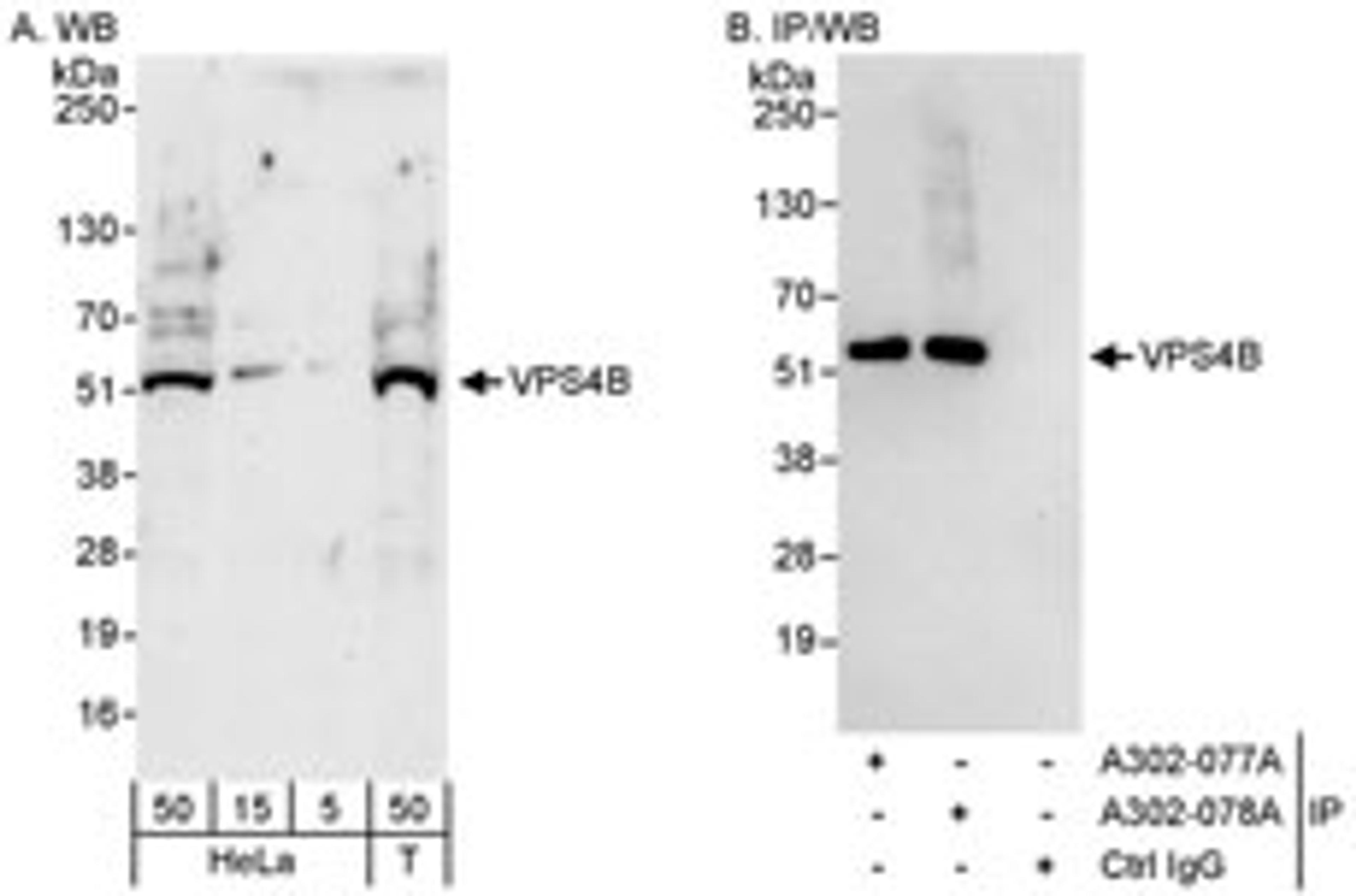 Detection of human VPS4B by western blot and immunoprecipitation.