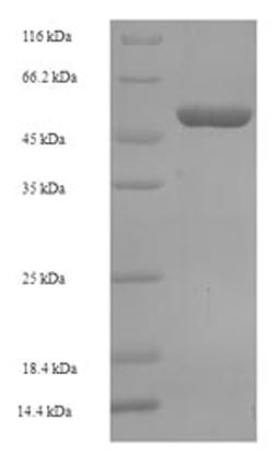 (Tris-Glycine gel) Discontinuous SDS-PAGE (reduced) with 5% enrichment gel and 15% separation gel.