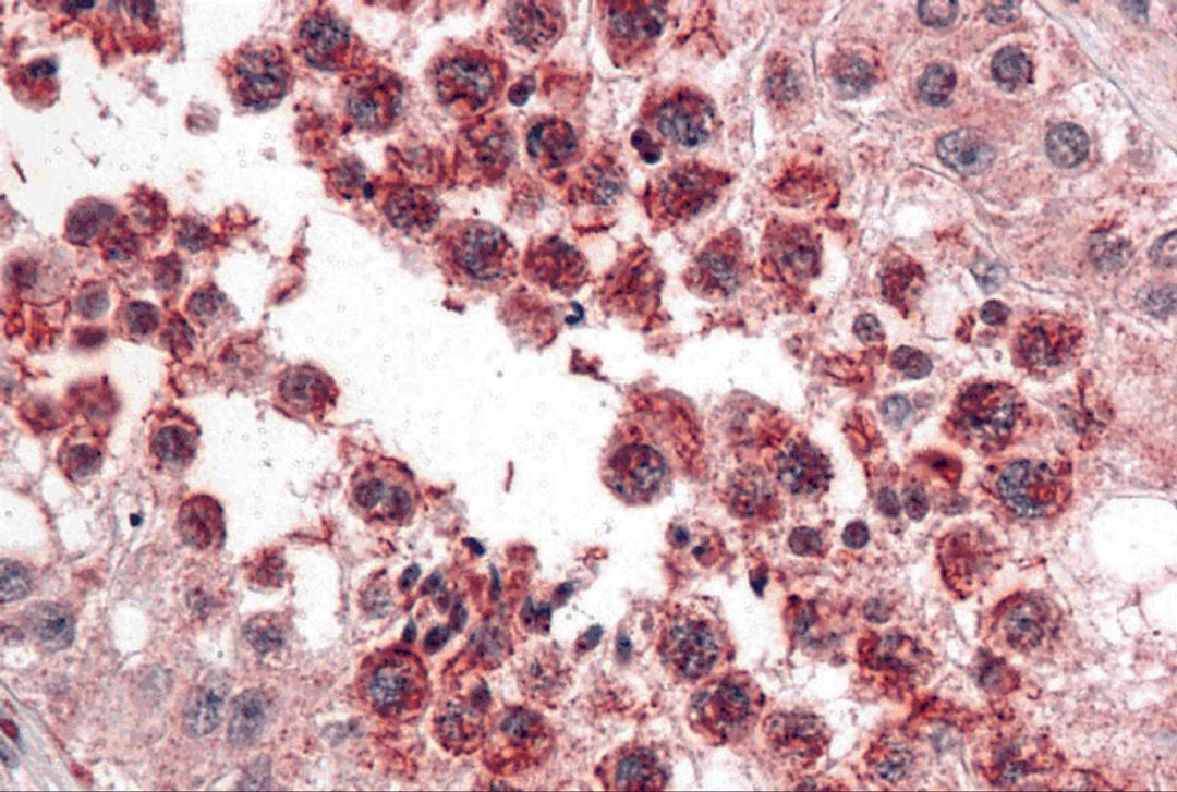 Immunohistochemistry of SLAIN2 in human testis with SLAIN2 antibody at 5 μg/mL.