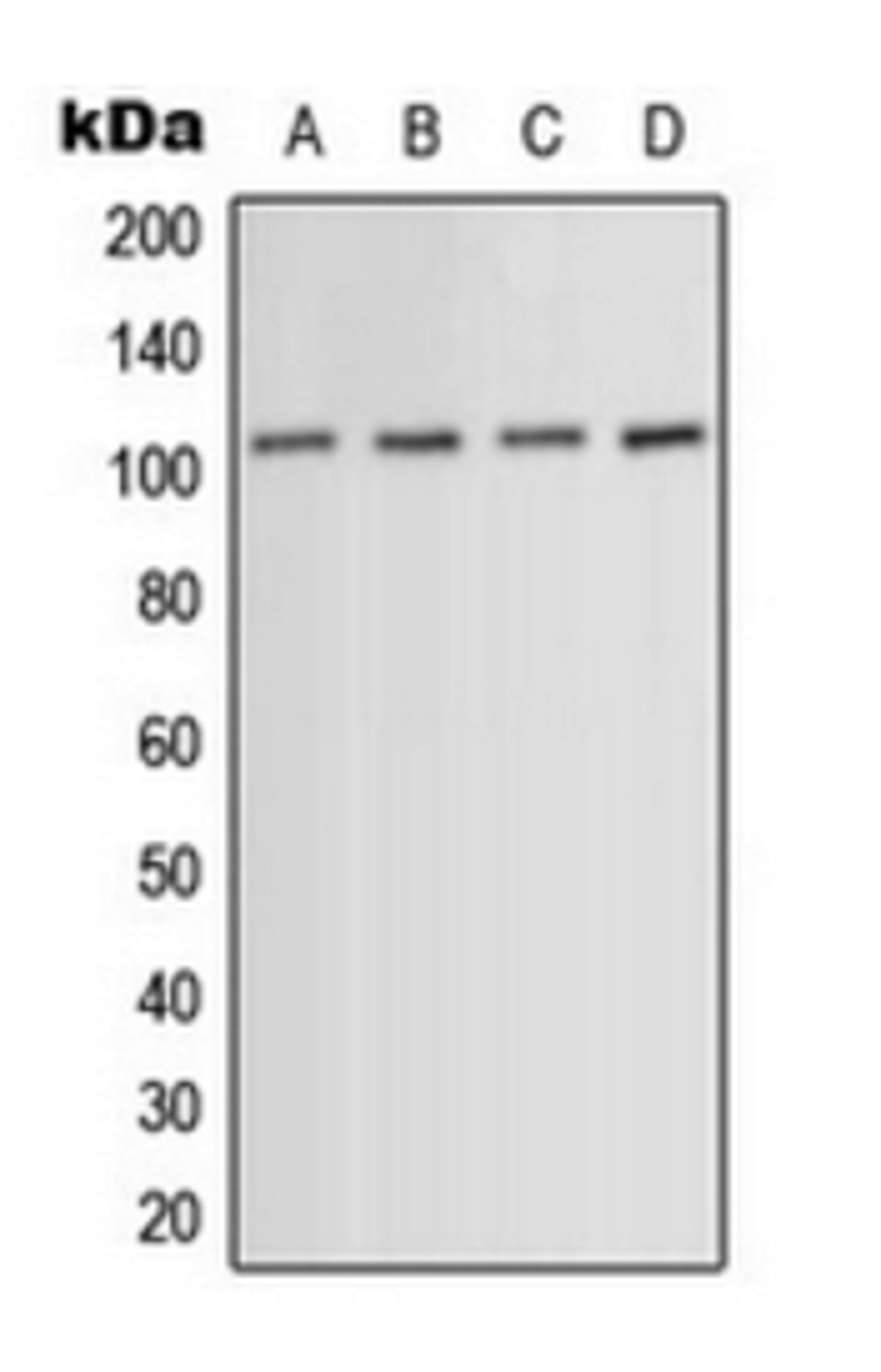 Western blot analysis of HeLa (Lane 1), HuvEc (Lane 2), mouse muscle (Lane 3), PC12 (Lane 4) whole cell lysates using ACTN1/2/3/4 antibody