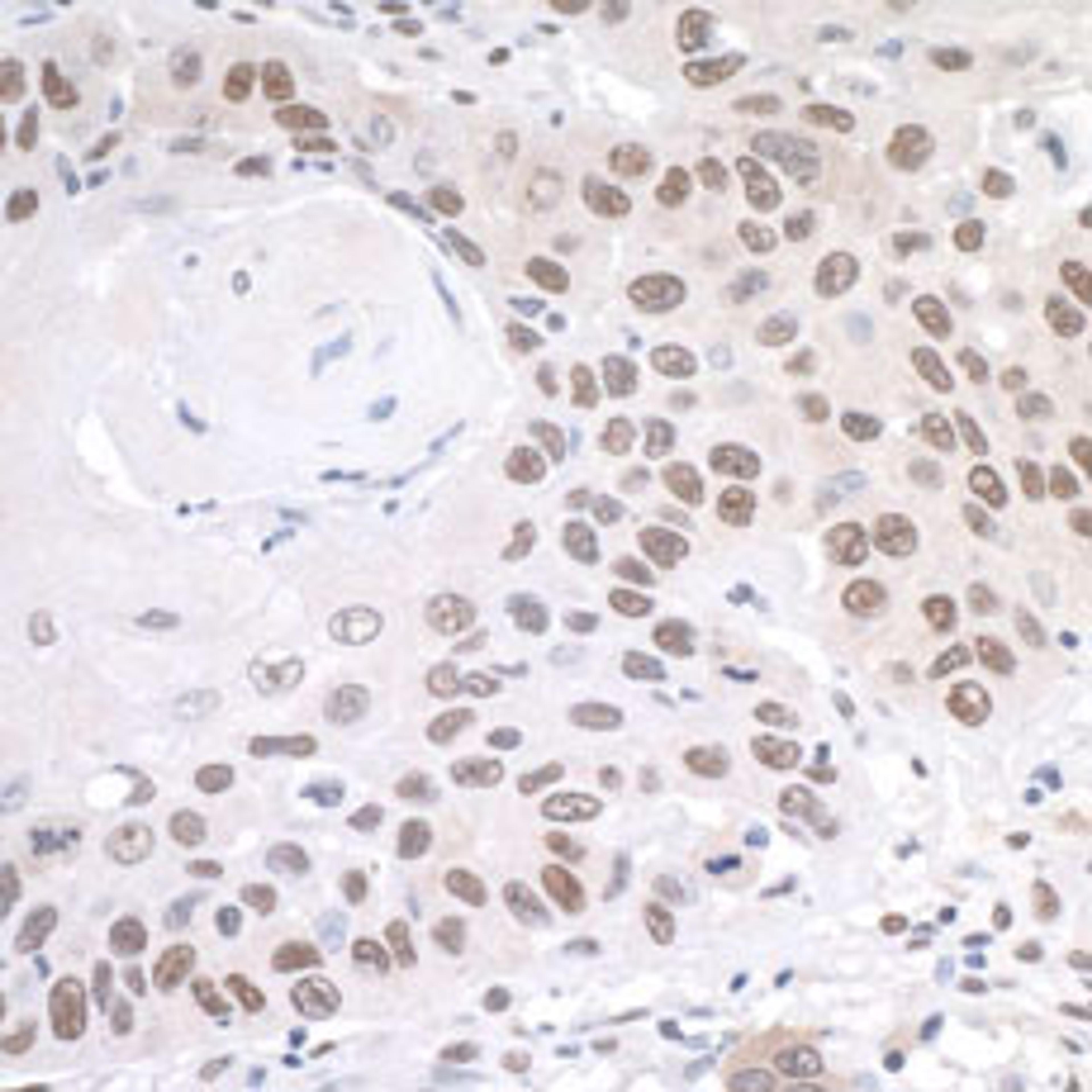 Detection of human PRMT1 by immunohistochemistry.