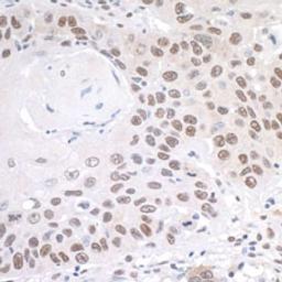 Detection of human PRMT1 by immunohistochemistry.