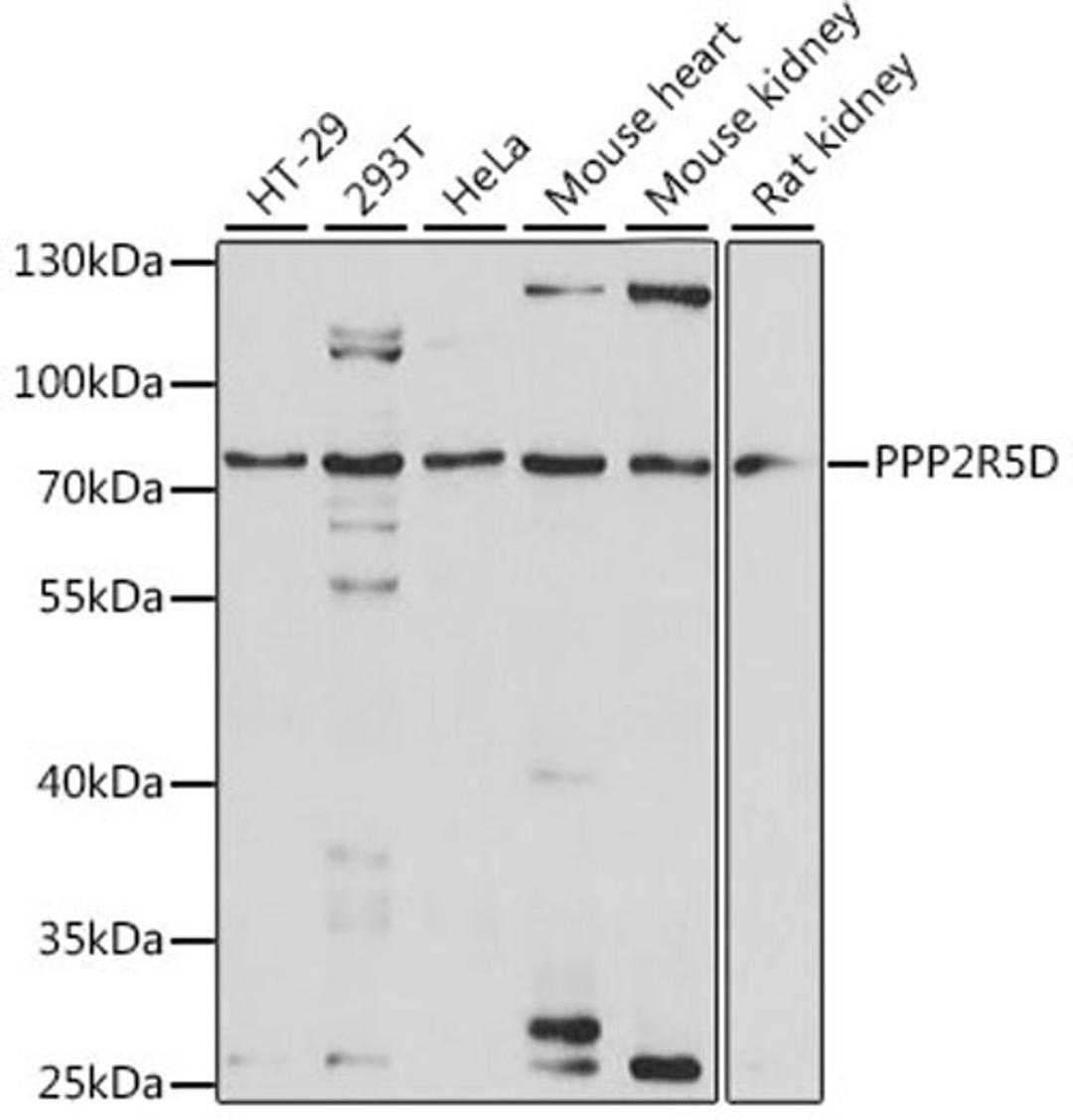 Western blot - PPP2R5D antibody (A15707)