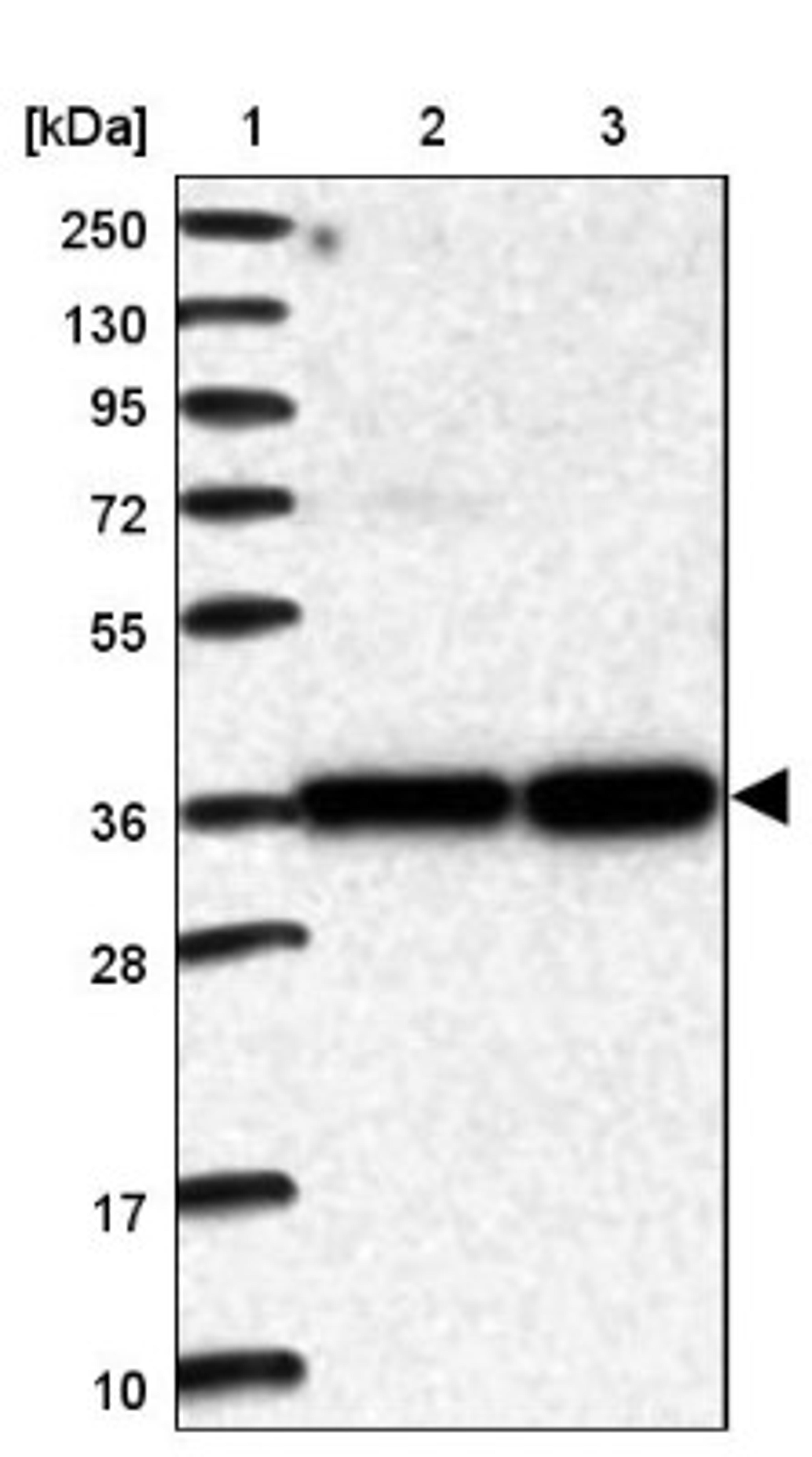 Western Blot: PCGF5 Antibody [NBP1-82745] - Lane 1: Marker [kDa] 250, 130, 95, 72, 55, 36, 28, 17, 10<br/>Lane 2: Human cell line RT-4<br/>Lane 3: Human cell line U-251MG sp