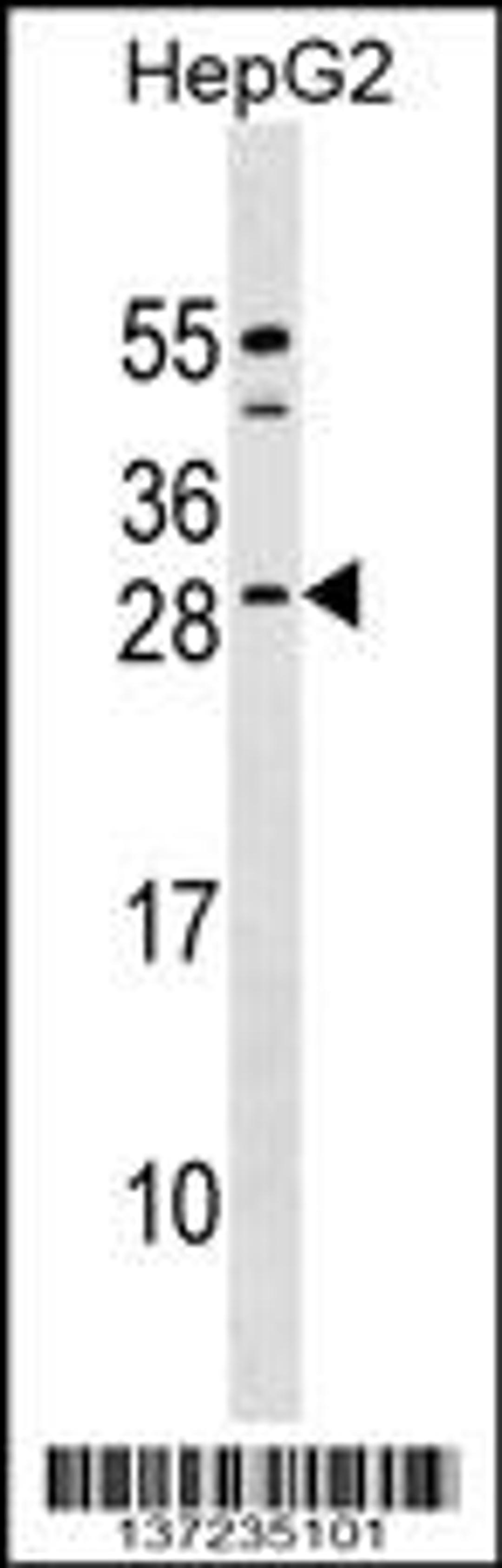 Western blot analysis in HepG2 cell line lysates (35ug/lane).