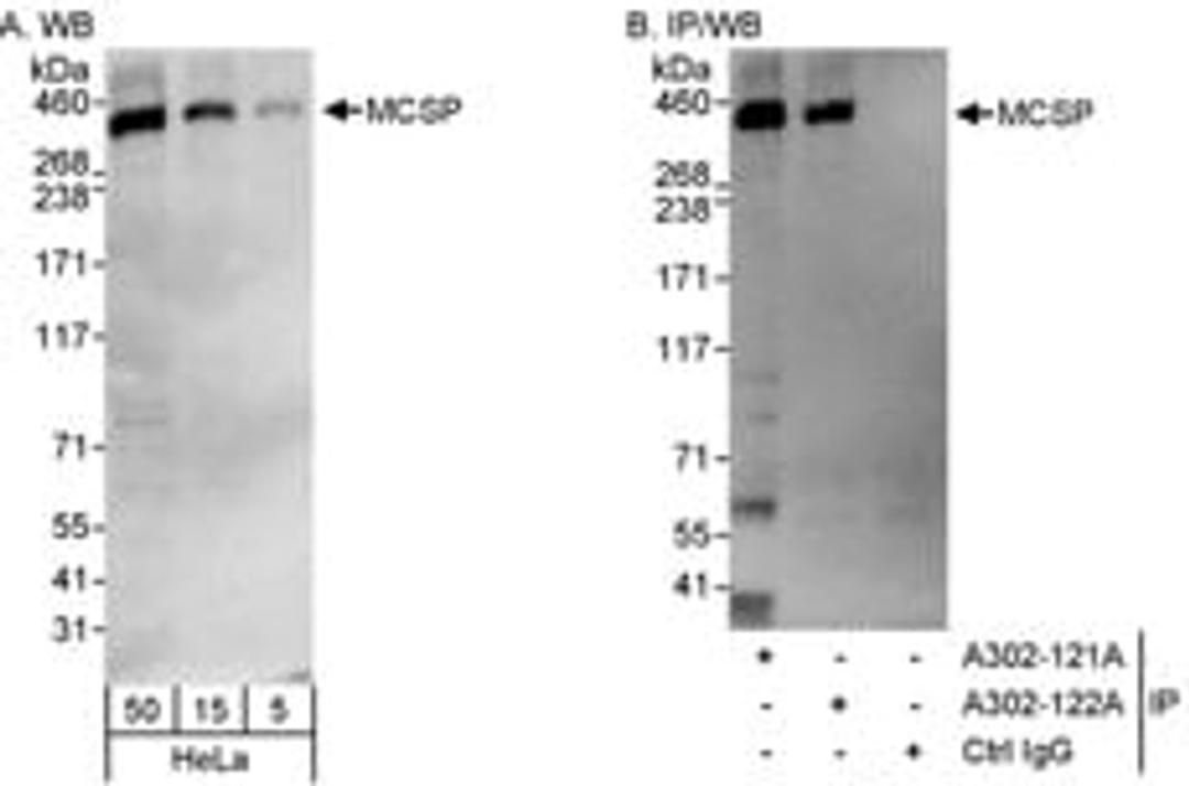 Detection of human MCSP by western blot and immunoprecipitation.