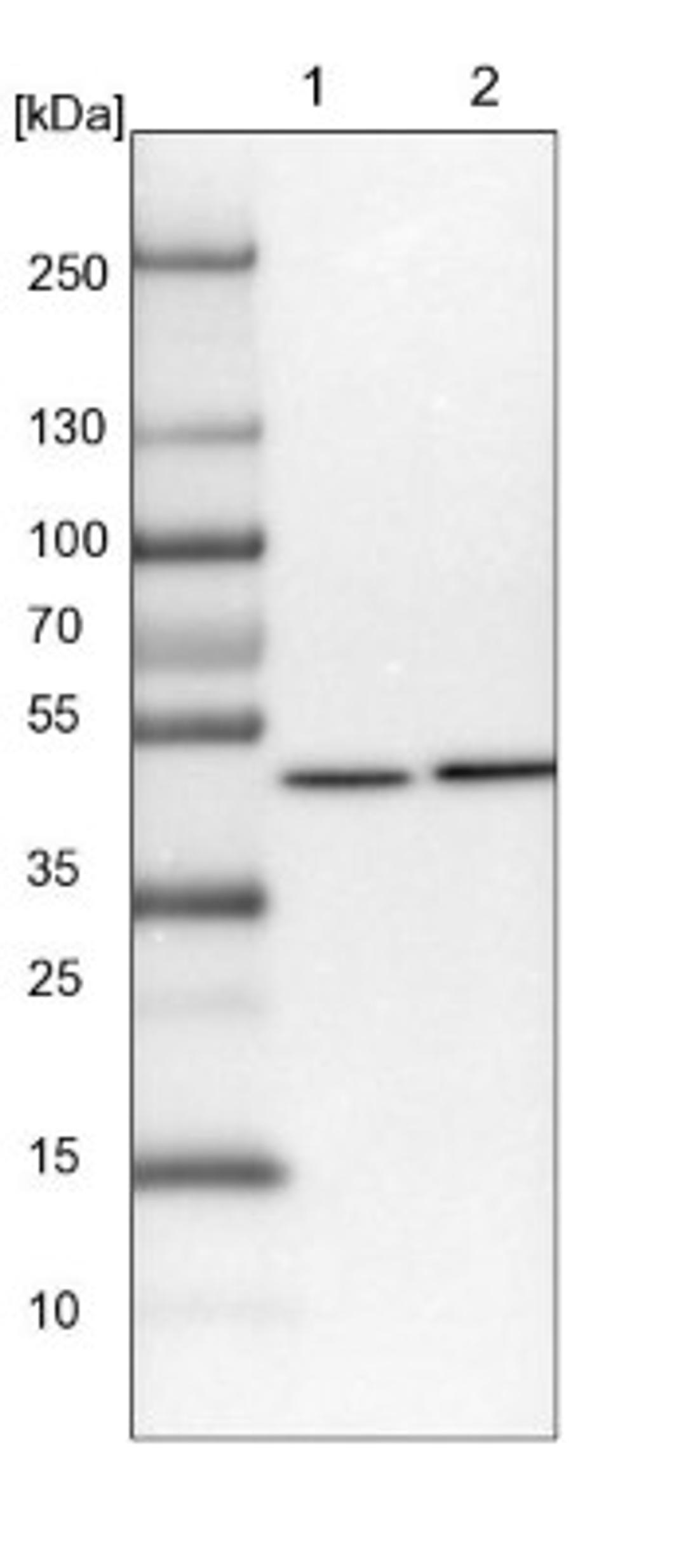 Western Blot: RCC1 Antibody [NBP1-85638] - Lane 1: NIH-3T3 cell lysate (Mouse embryonic fibroblast cells)<br/>Lane 2: NBT-II cell lysate (Rat Wistar bladder tumour cells)