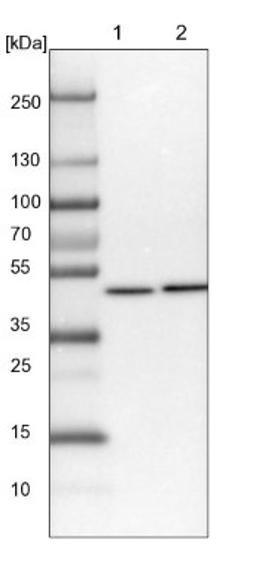 Western Blot: RCC1 Antibody [NBP1-85638] - Lane 1: NIH-3T3 cell lysate (Mouse embryonic fibroblast cells)<br/>Lane 2: NBT-II cell lysate (Rat Wistar bladder tumour cells)