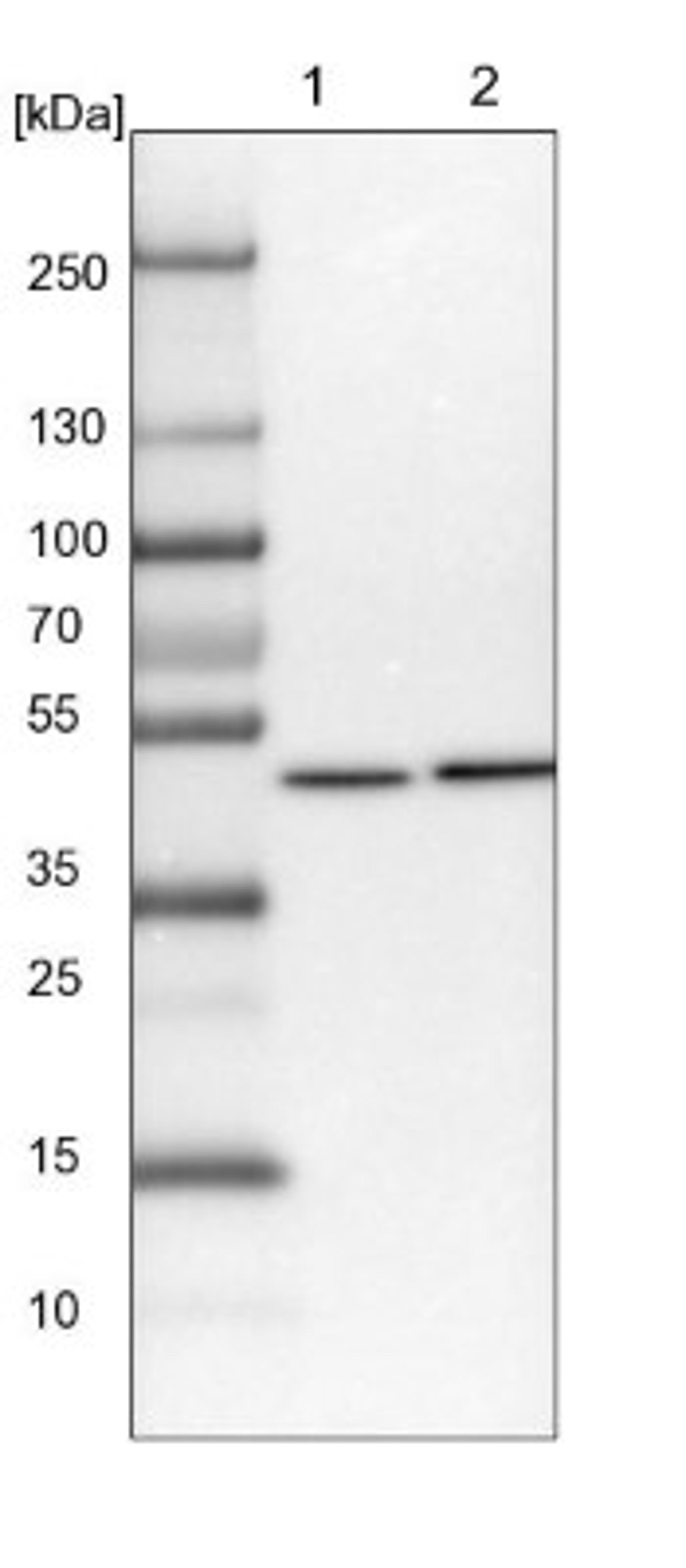 Western Blot: RCC1 Antibody [NBP1-85638] - Lane 1: NIH-3T3 cell lysate (Mouse embryonic fibroblast cells)<br/>Lane 2: NBT-II cell lysate (Rat Wistar bladder tumour cells)