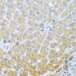 Immunohistochemical staining of human liver tissue using IL20 antibody (dilution of 1:100)