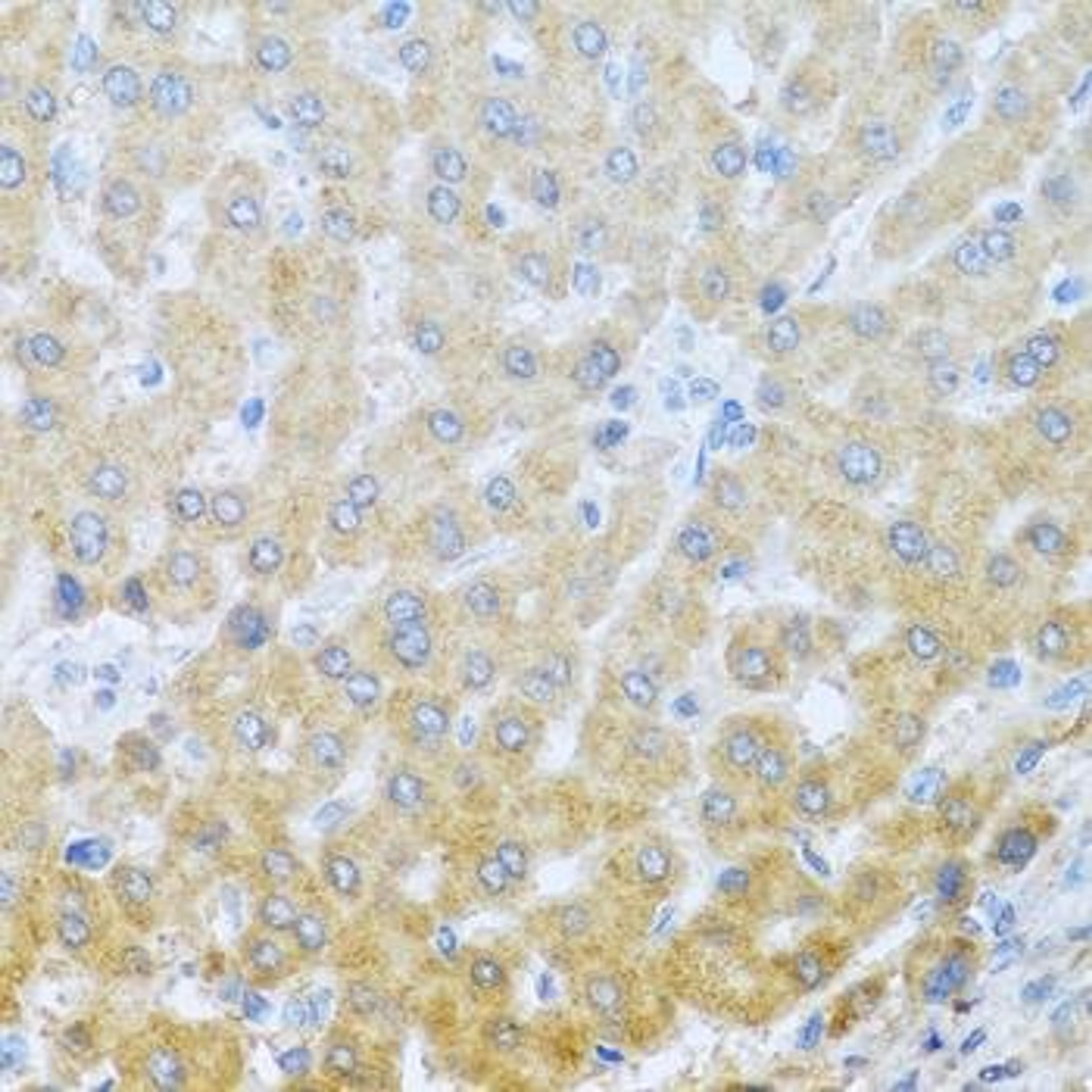 Immunohistochemical staining of human liver tissue using IL20 antibody (dilution of 1:100)