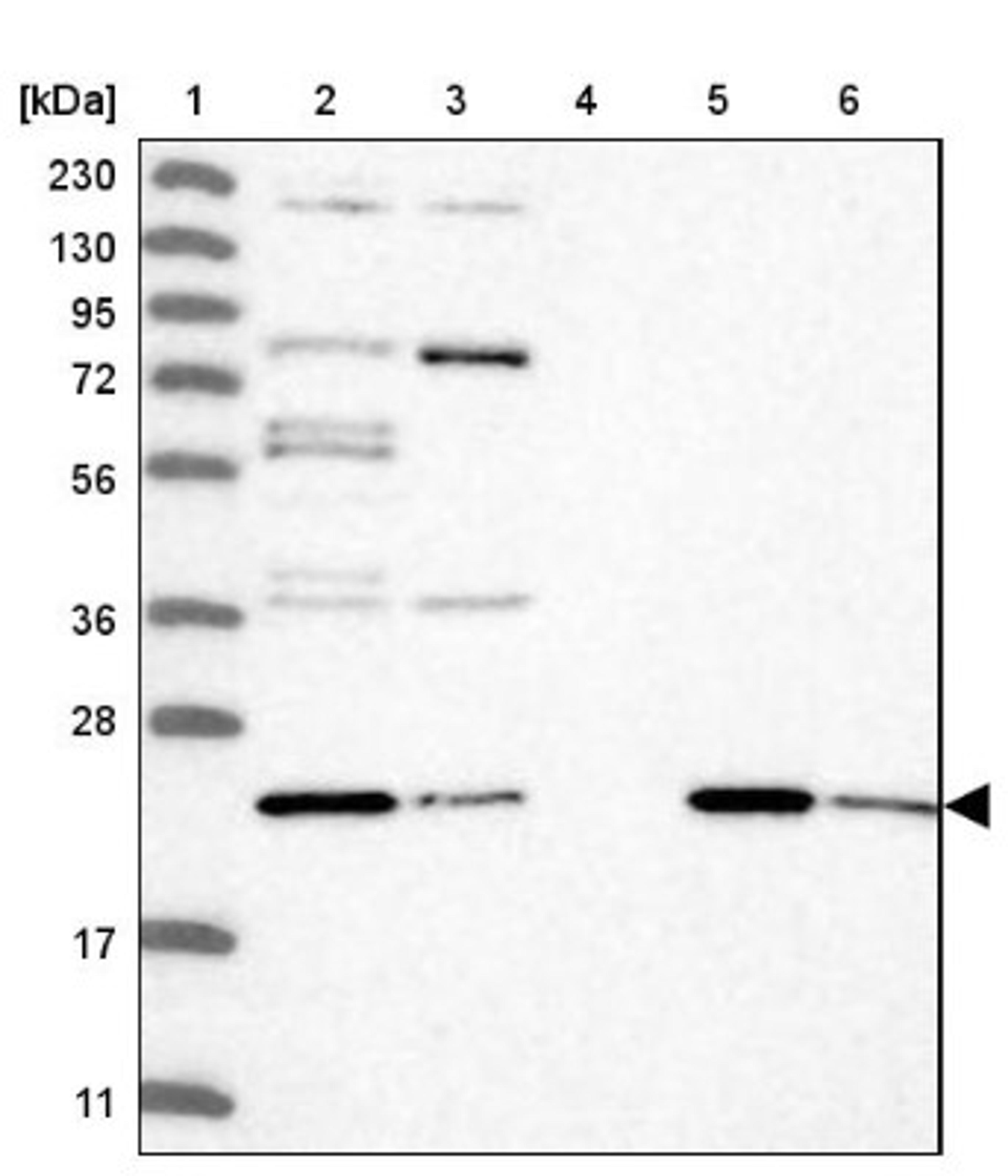 Western Blot: C7orf45 Antibody [NBP1-81915] - Lane 1: Marker [kDa] 230, 130, 95, 72, 56, 36, 28, 17, 11<br/>Lane 2: Human cell line RT-4<br/>Lane 3: Human cell line U-251MG sp<br/>Lane 4: Human plasma (IgG/HSA depleted)<br/>Lane 5: Human liver tissue<br/>Lane 6: Human tonsil tissue