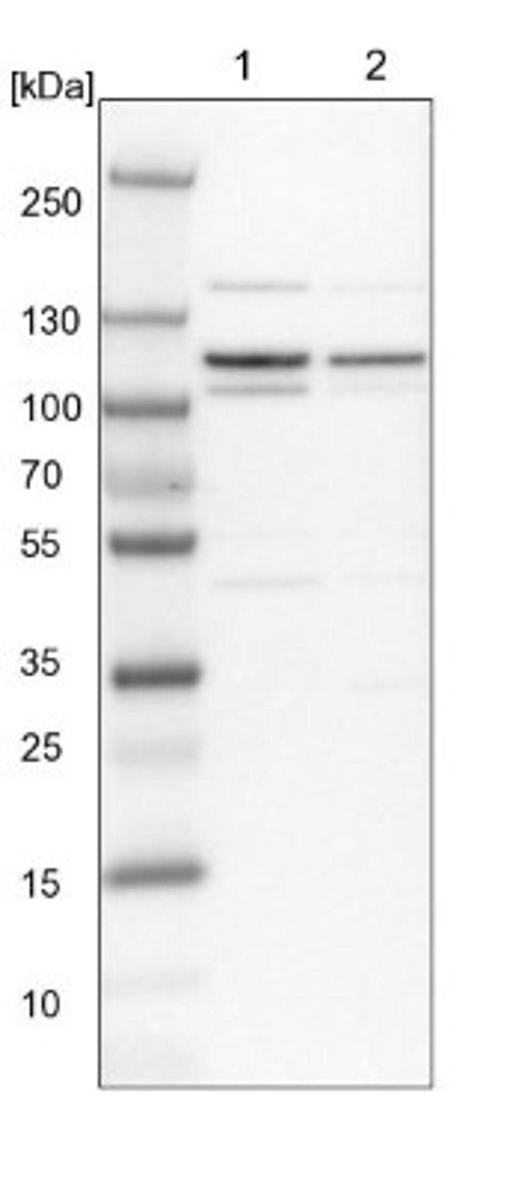 Western Blot: p130 Antibody [NBP1-82455] - Lane 1: NIH-3T3 cell lysate (Mouse embryonic fibroblast cells)<br/>Lane 2: NBT-II cell lysate (Rat Wistar bladder tumour cells)