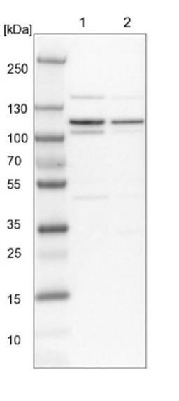 Western Blot: p130 Antibody [NBP1-82455] - Lane 1: NIH-3T3 cell lysate (Mouse embryonic fibroblast cells)<br/>Lane 2: NBT-II cell lysate (Rat Wistar bladder tumour cells)