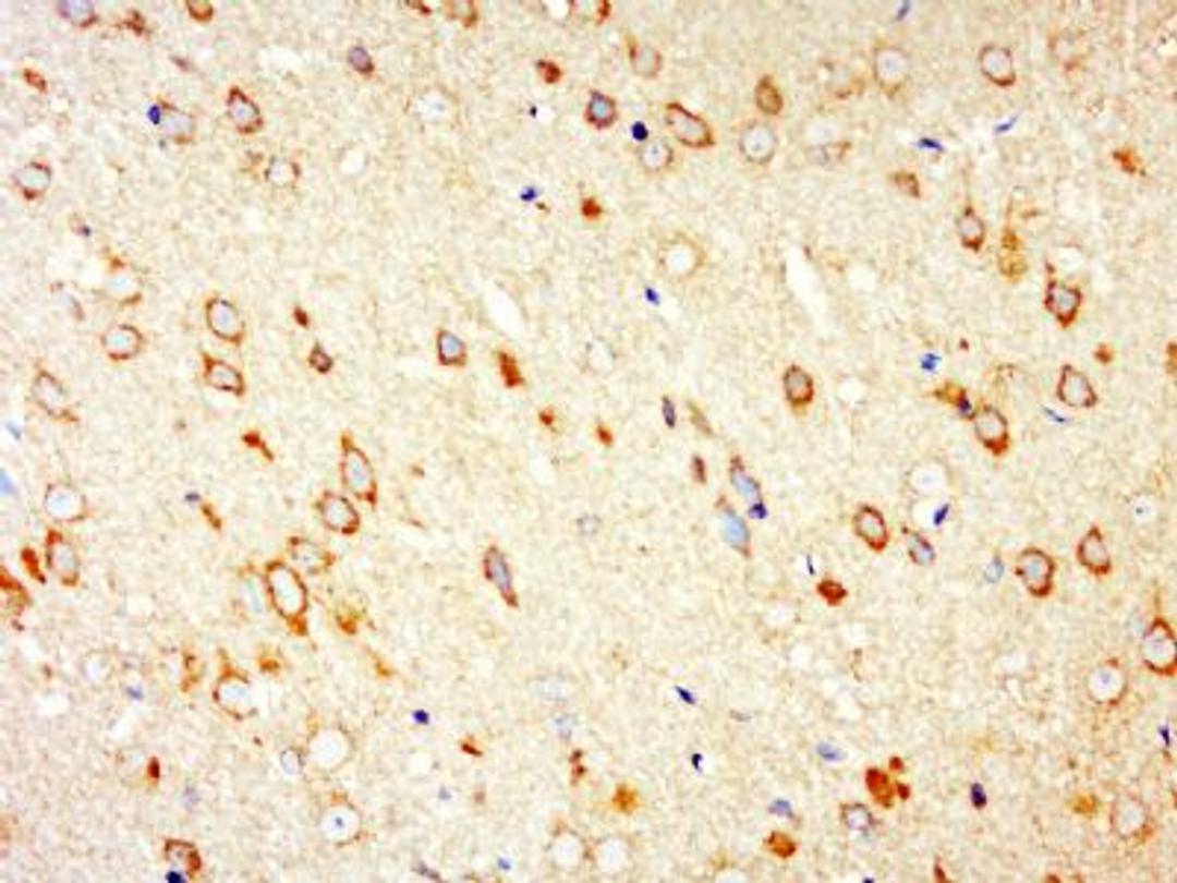 Immunohistochemical staining of rat brain tissue using PARK9 antibody.