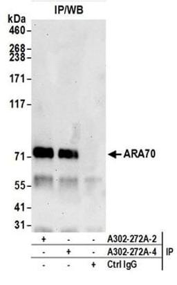 Detection of human ARA70 by western blot of immunoprecipitates.