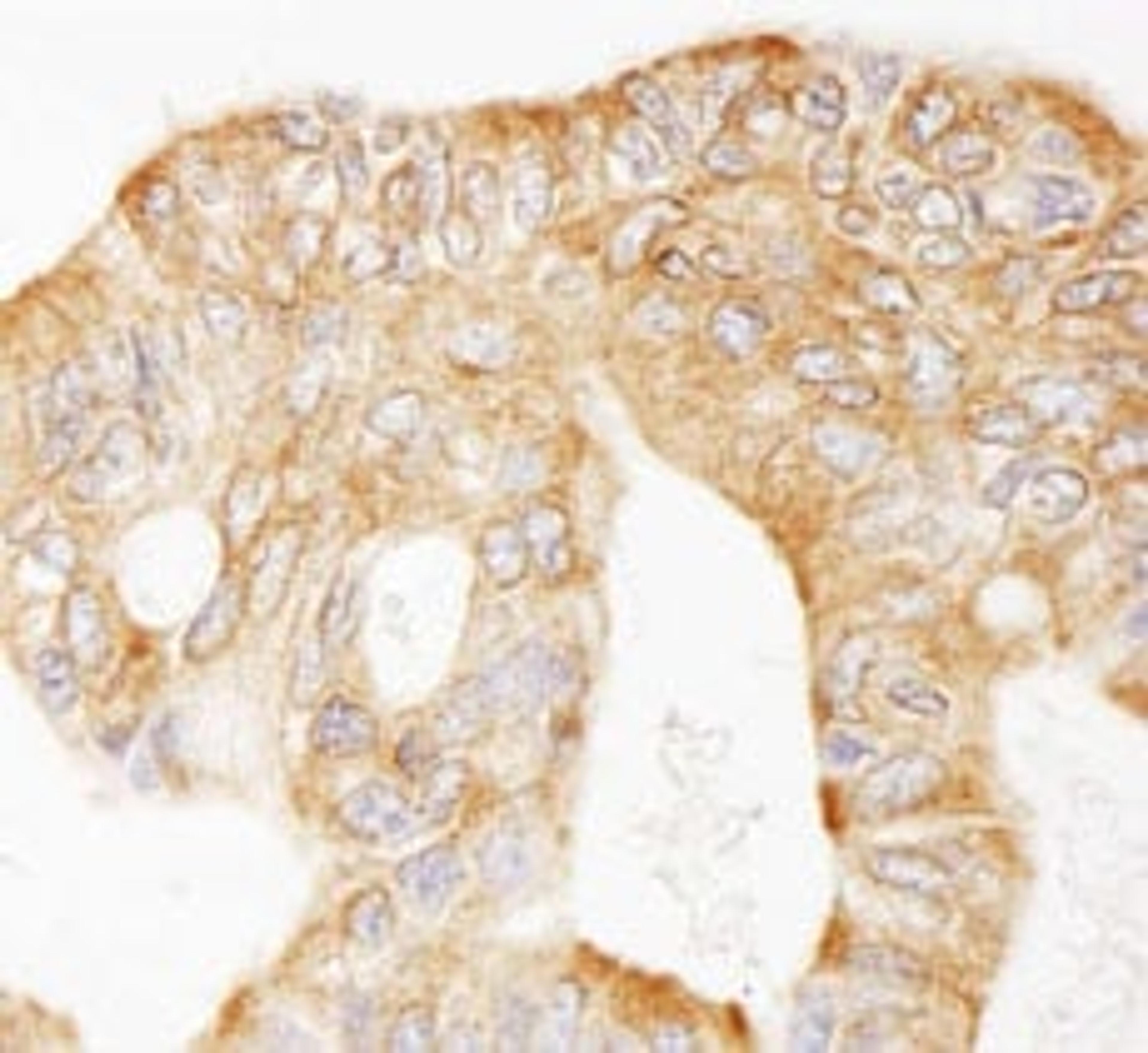 Detection of human MAP4 by immunohistochemistry.