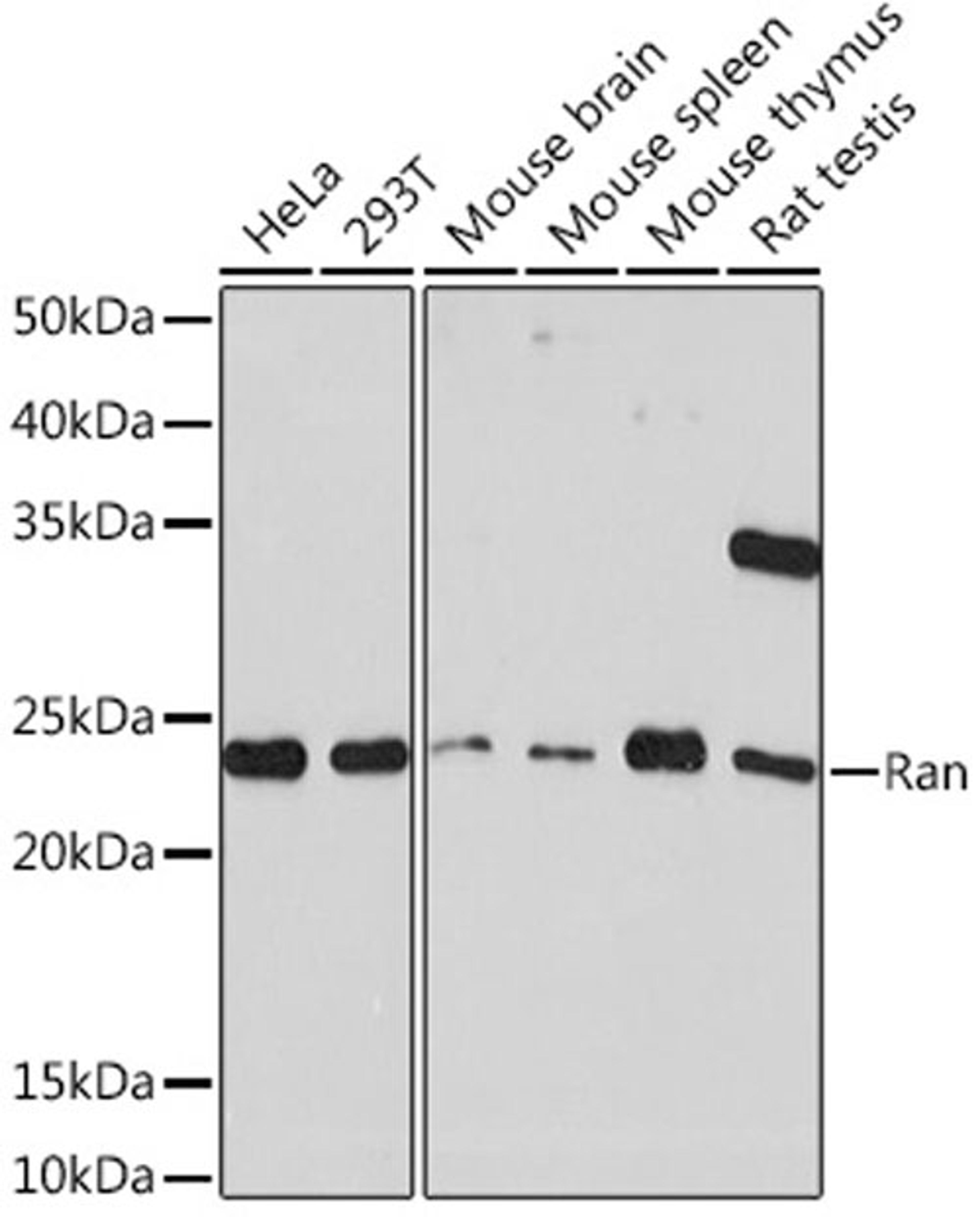 Western blot - Ran Rabbit mAb (A4374)