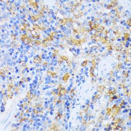 Immunohistochemistry  - AARS antibody (A15017)